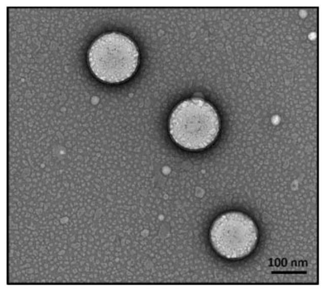 Nanoformulations for topical and systemic fat reduction and uses thereof