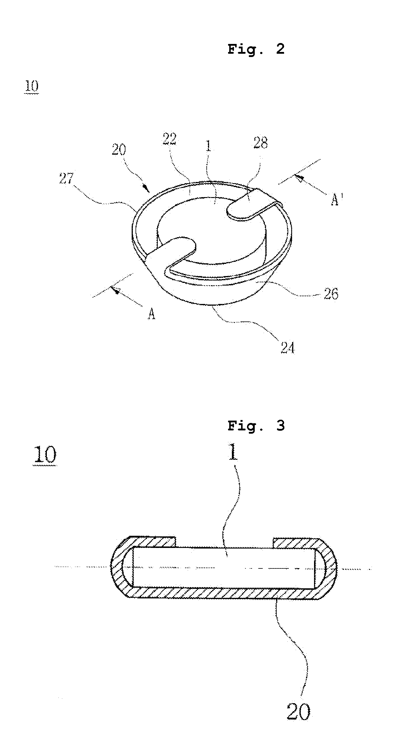 Magnetic reinforcing and reducing acupuncture method employing the ionization tendency of metals