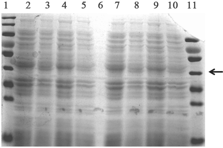 A kind of recombinant human type III collagen and its prokaryotic expression method