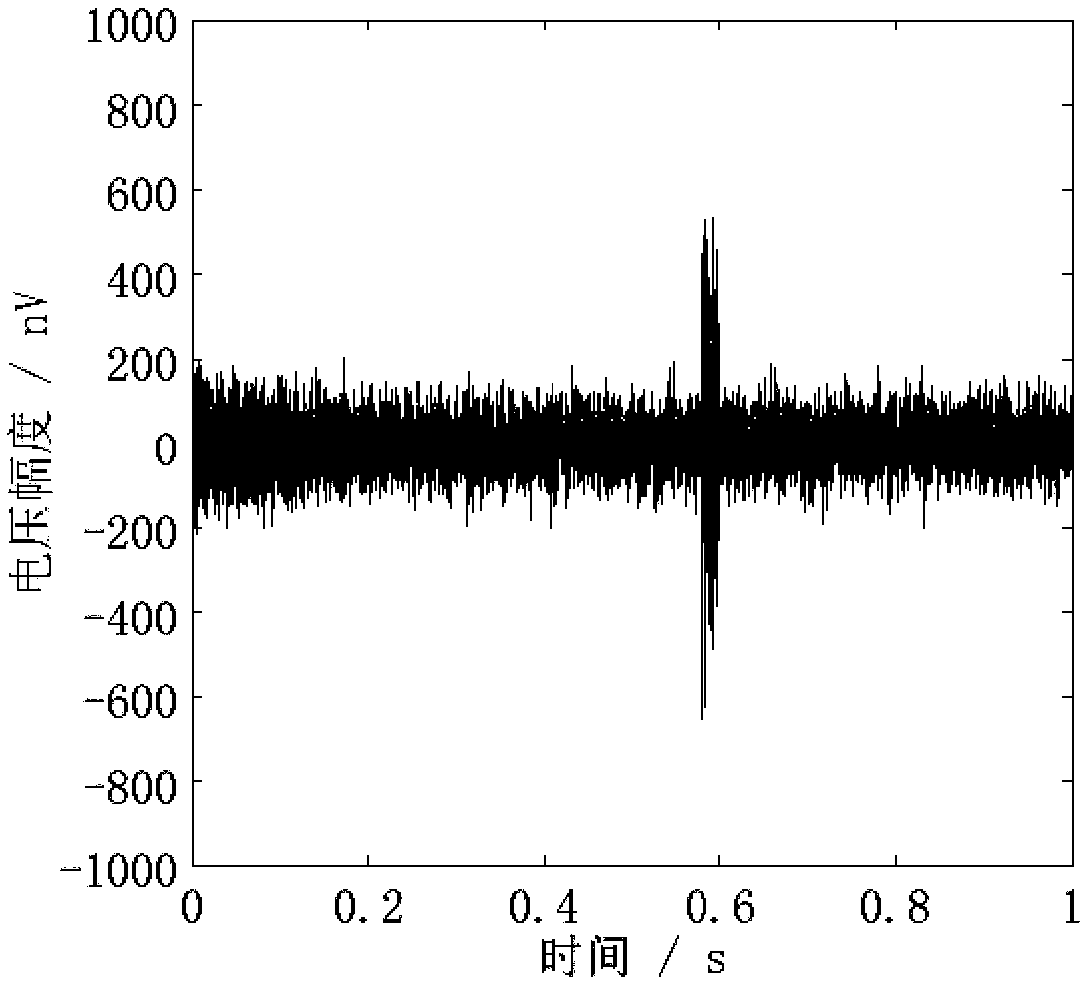 Method of removing spike noise from ground nuclear magnetic resonance data based on synergic filtration