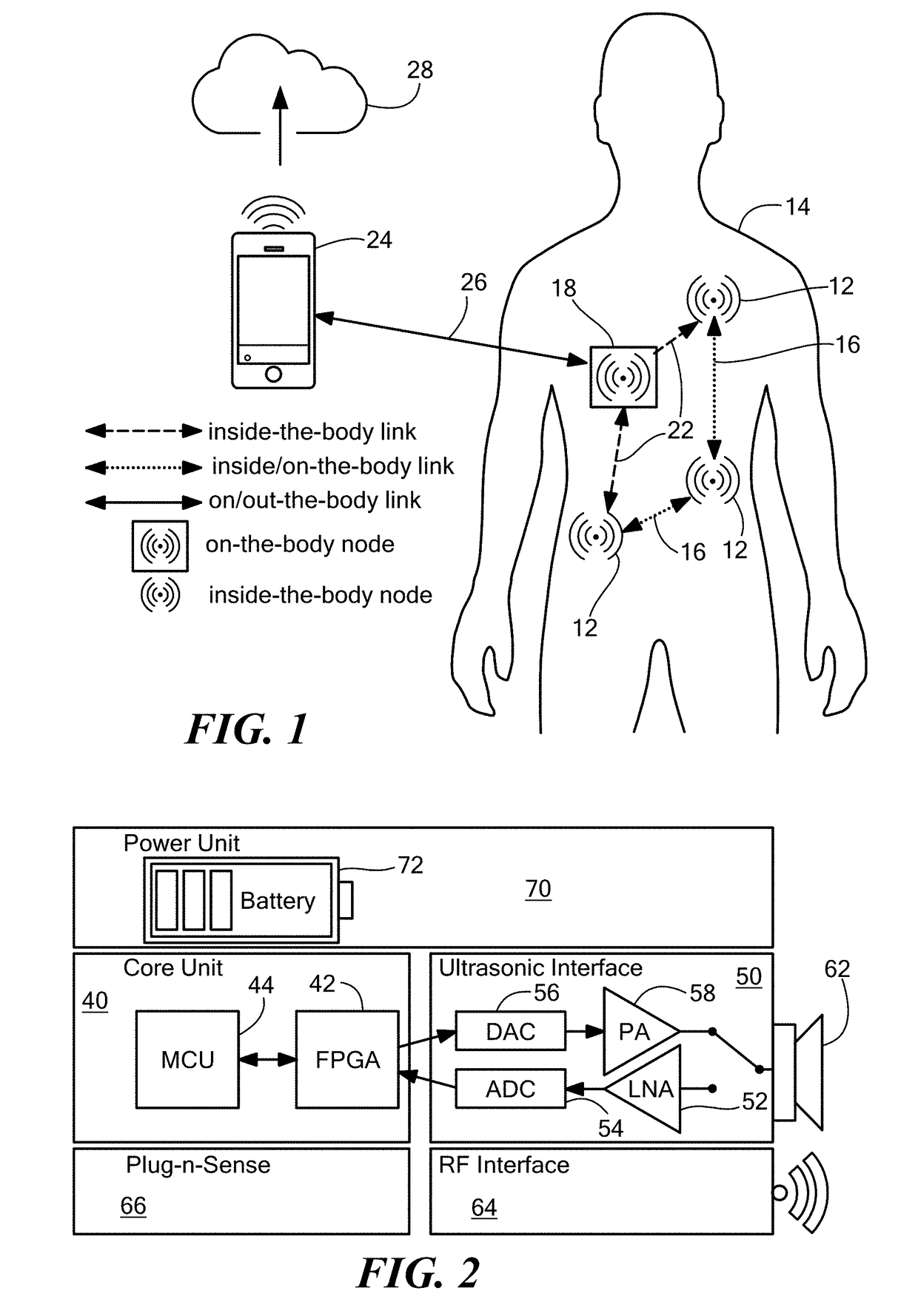 Software-Defined Implantable Ultrasonic Device for Use in the Internet of Medical Things