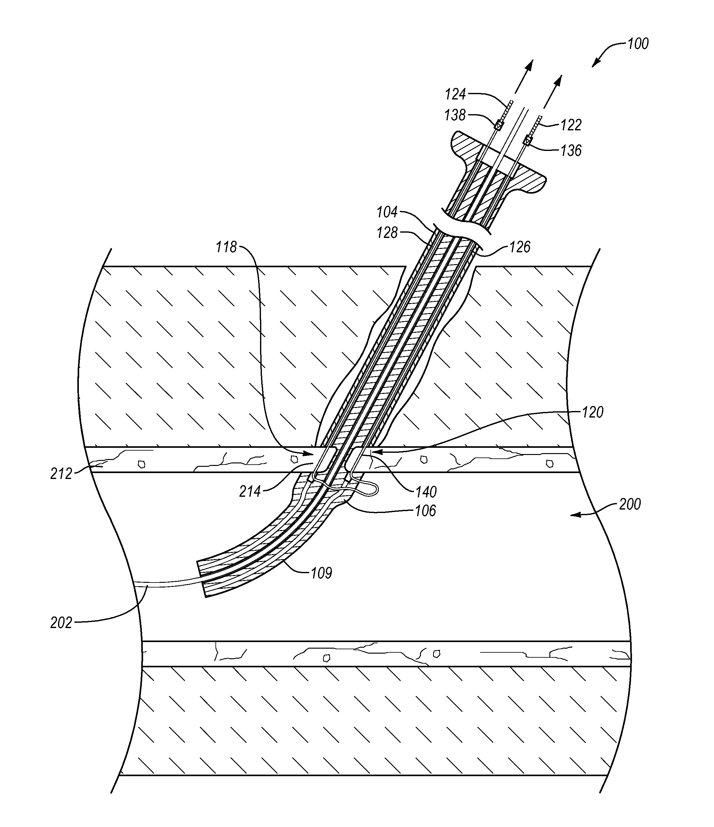 Suturing devices and methods