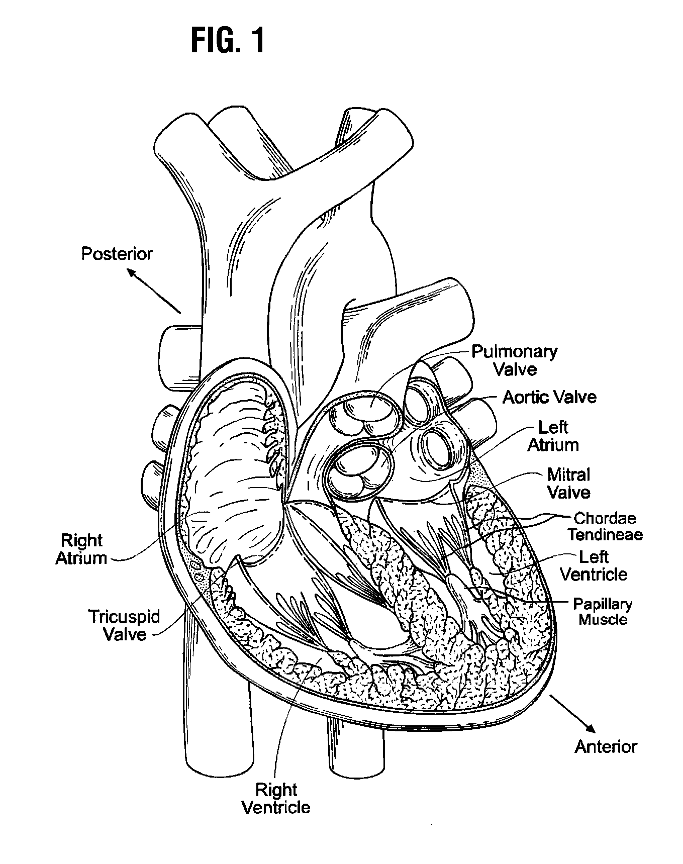 Systems for rapidly deploying surgical heart valves