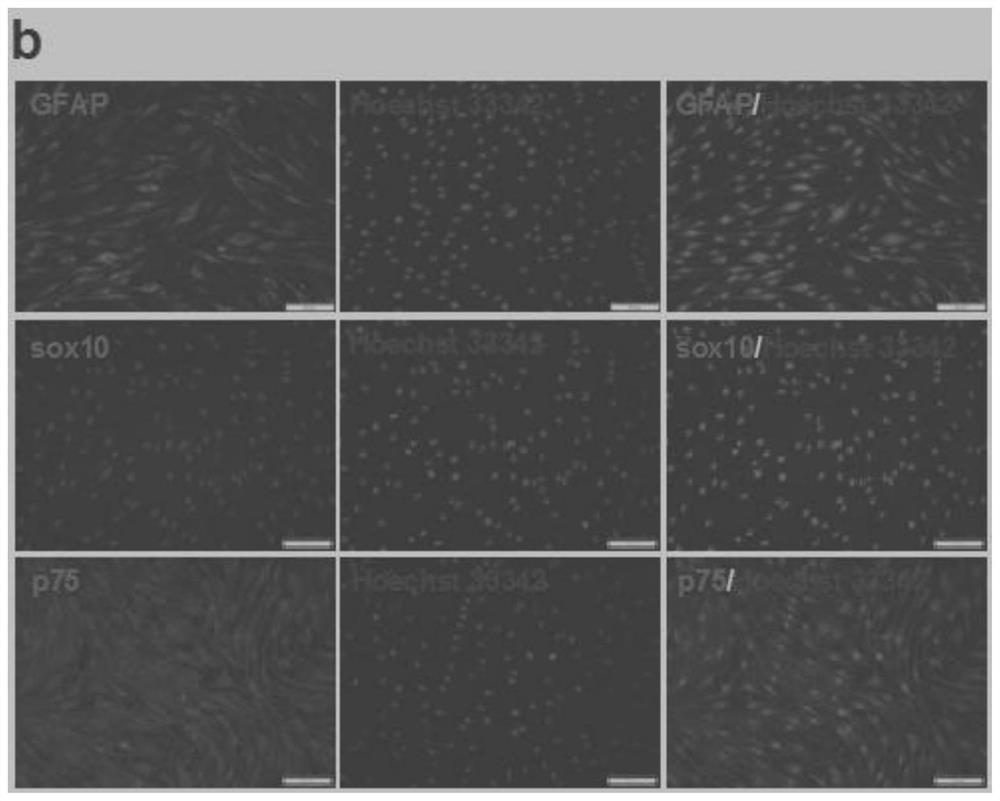 The application of mir containing the specific seed base sequence at the 5' end, the improved Schwann cell and its application