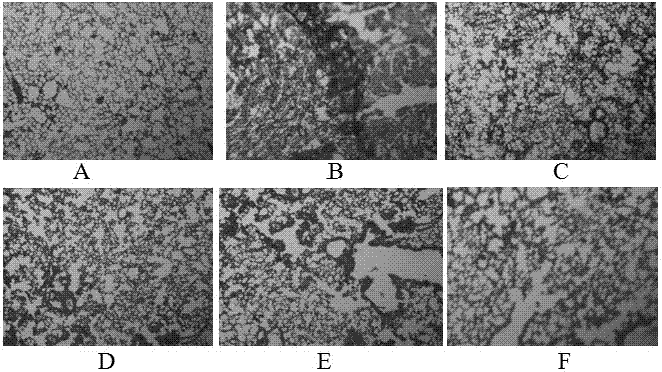 Application of eucheuma polypeptide in prevention and treatment of pulmonary fibrosis