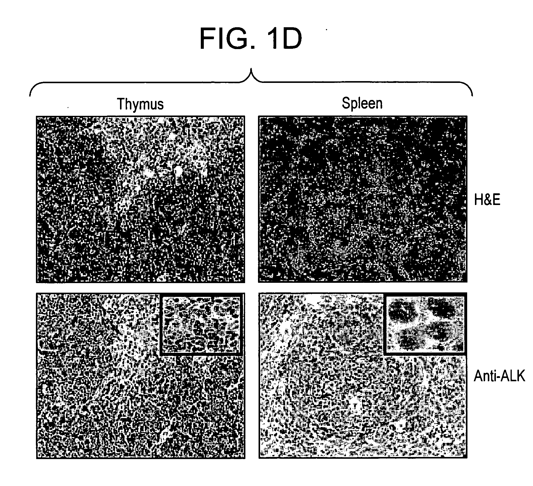 ALK protein tyrosine kinase, cells and methods embodying and using same