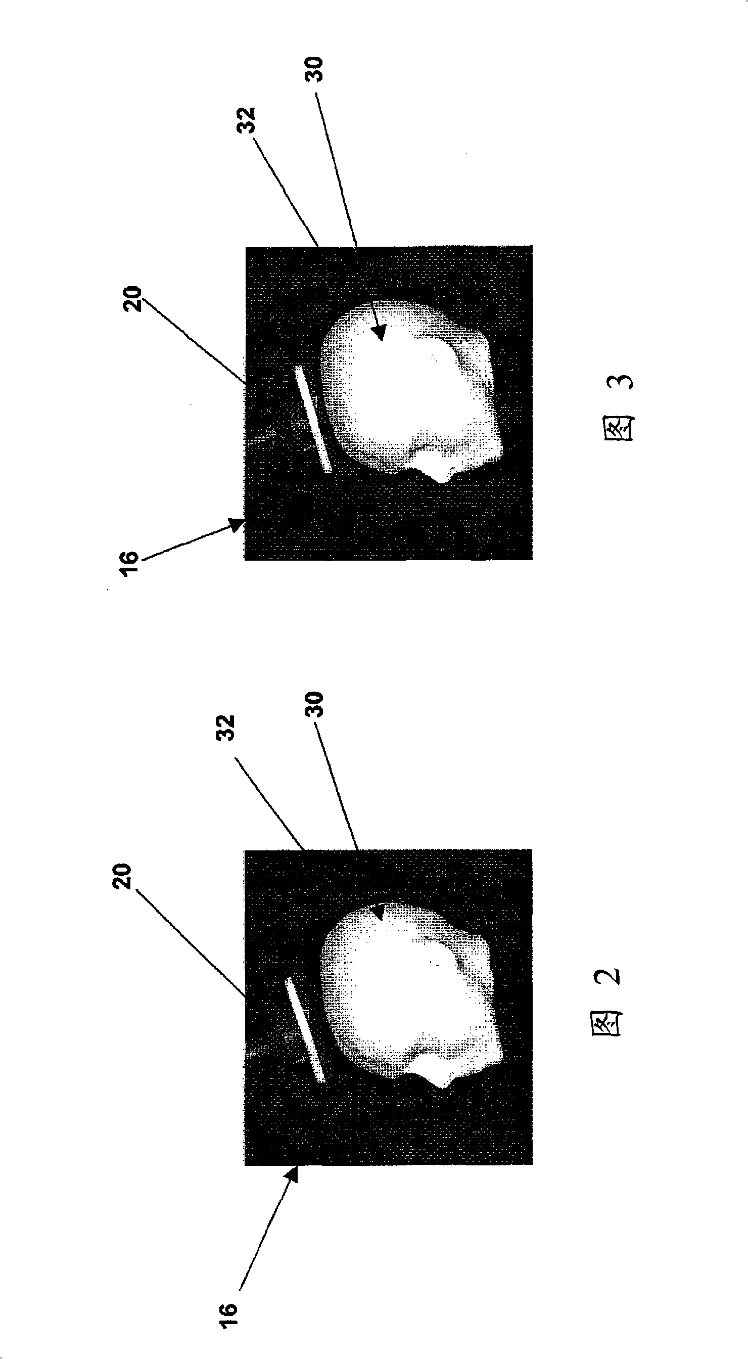 Method and apparatus for correcting an error in the co-registration of coordinate systems used to represent objects displayed during navigated brain stimulation