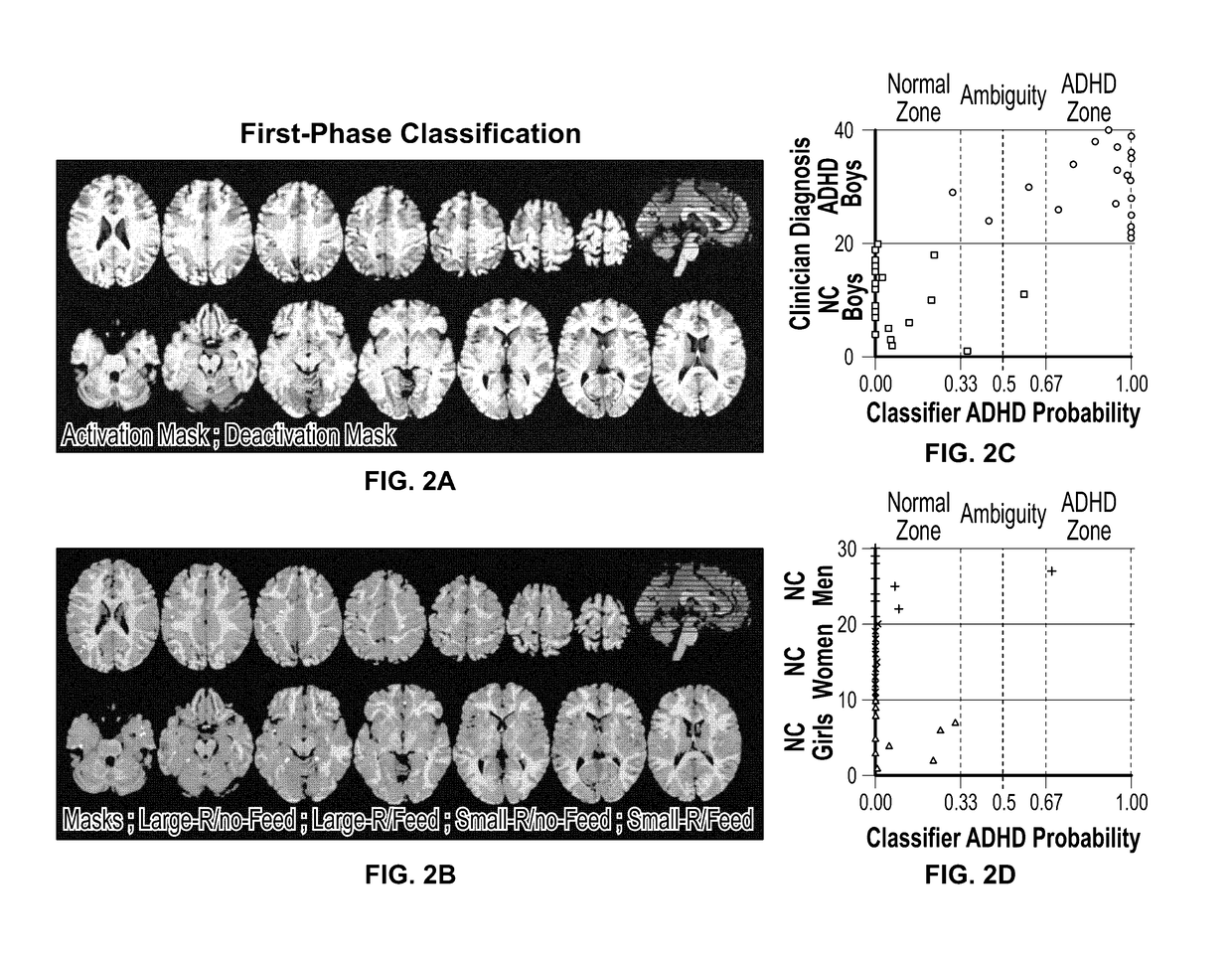 PATTERN ANALYSIS BASED ON fMRI DATA COLLECTED WHILE SUBJECTS PERFORM WORKING MEMORY TASKS ALLOWING HIGH-PRECISION DIAGNOSIS OF ADHD