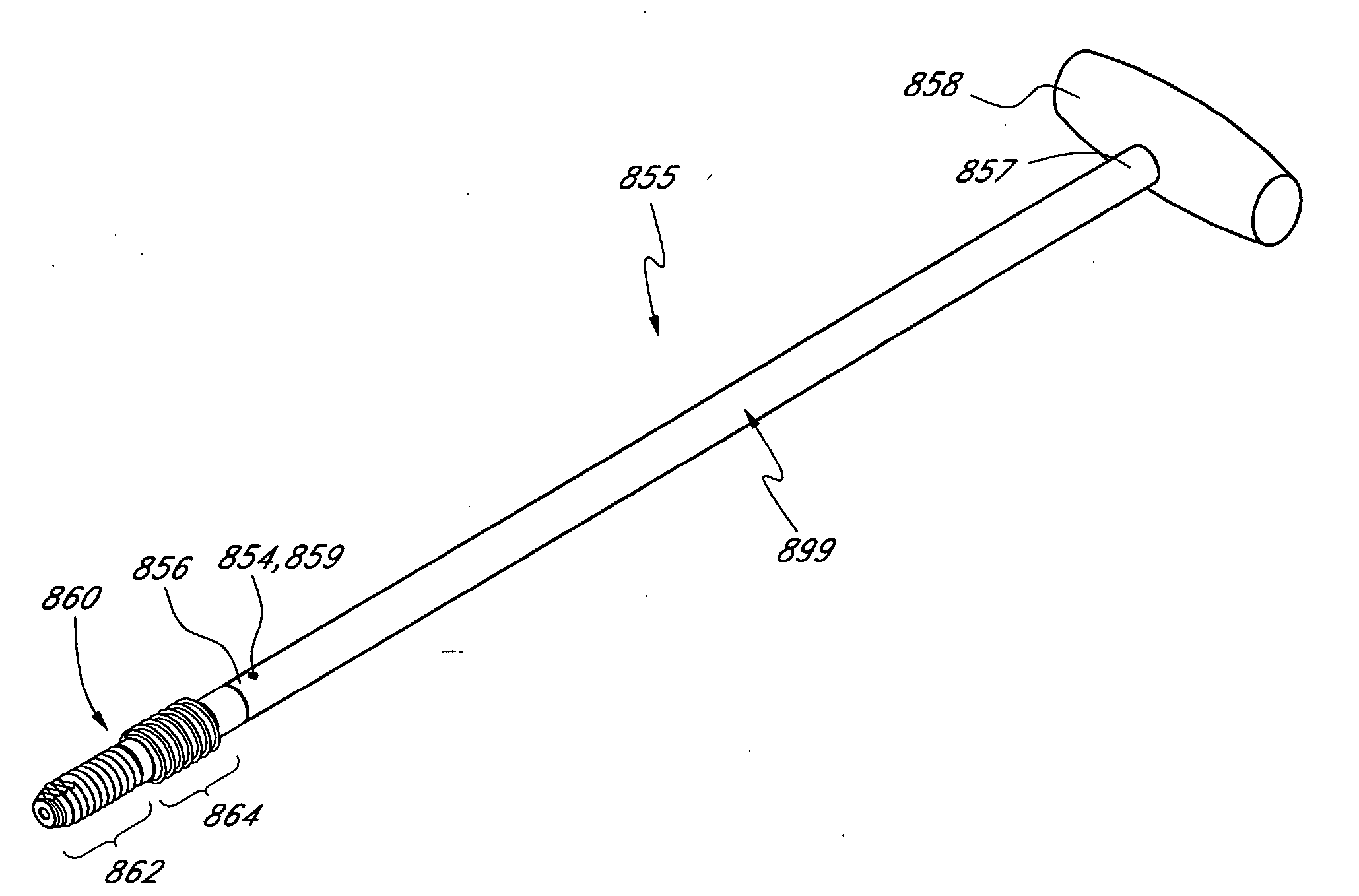 Method and apparatus for spinal distraction