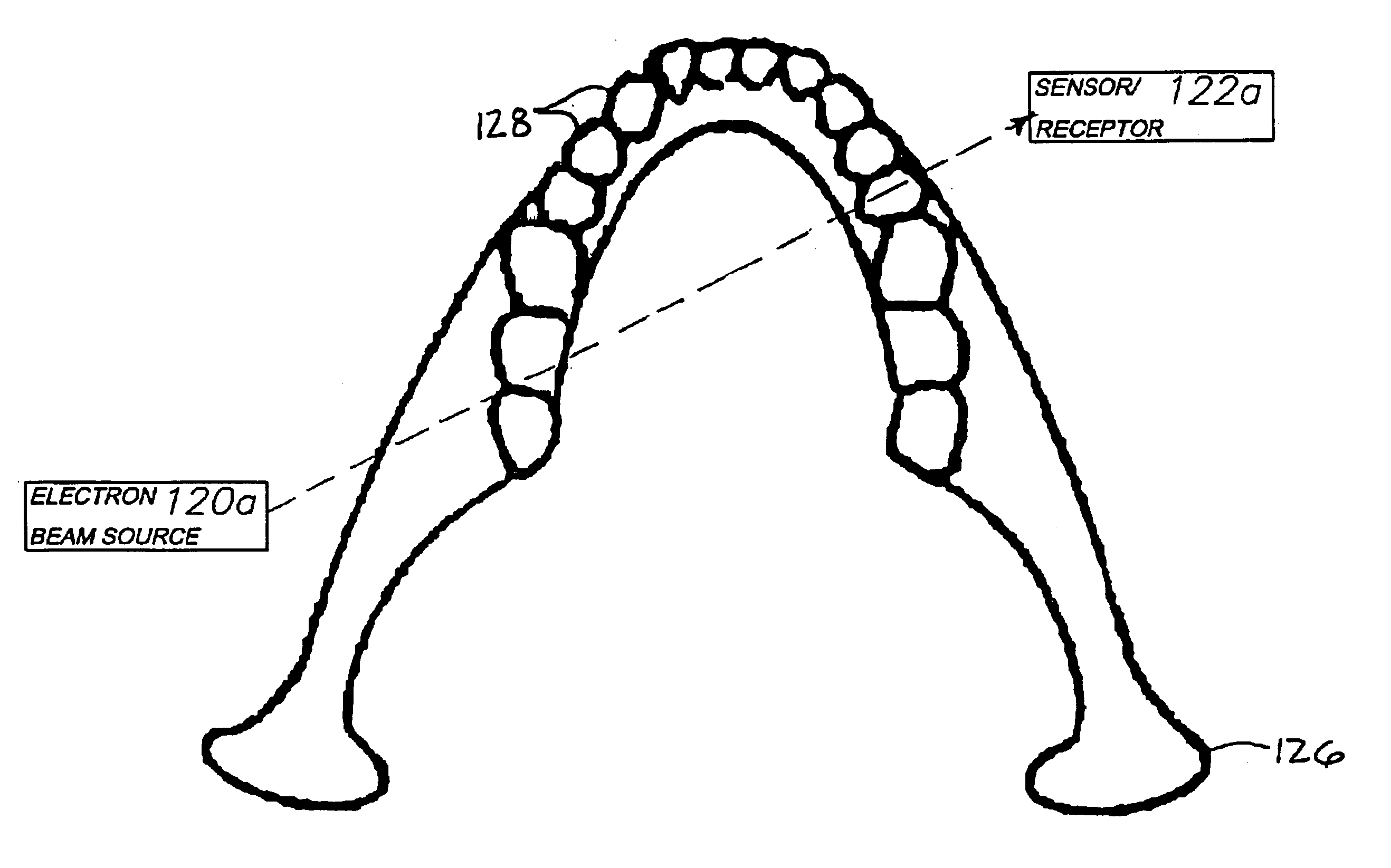 Dental and orthopedic densitometry modeling system and method
