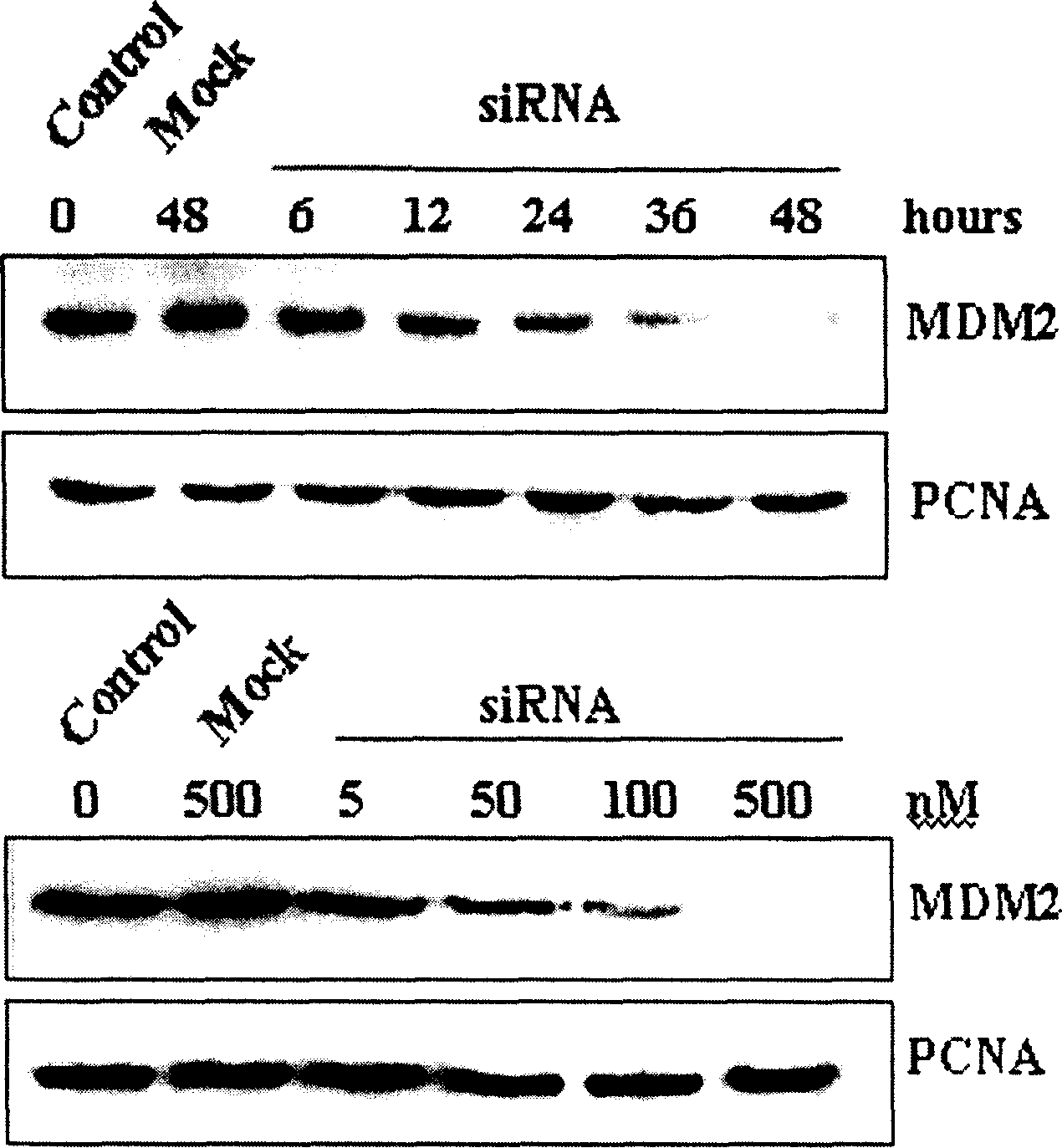 Gene therapeutic drug hdm2-siRNA for breast cancer