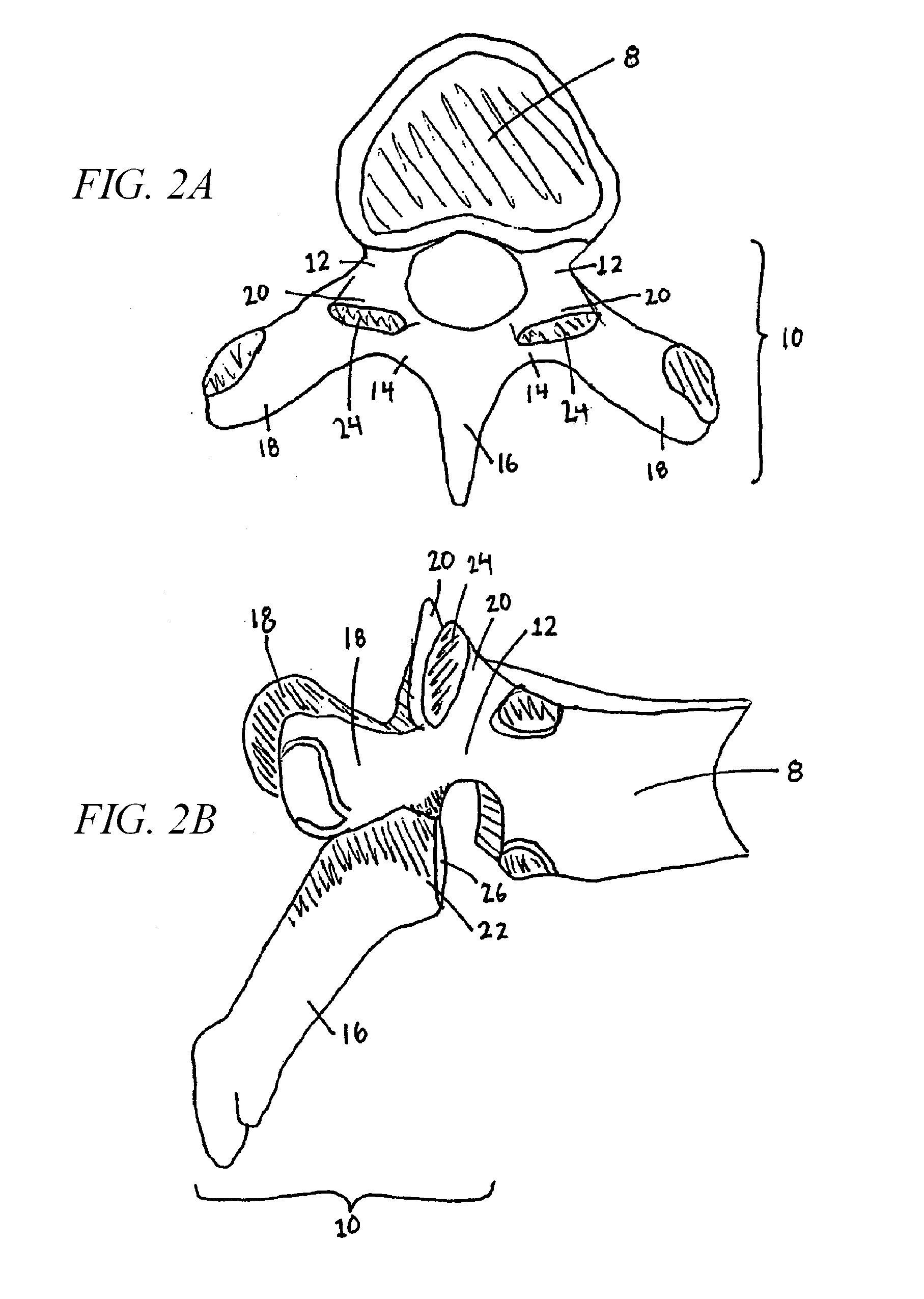 Vertebral facet joint drill and method of use