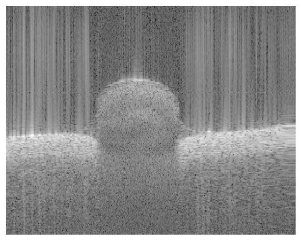 A Blood Vessel Segmentation Method Based on Optical Coherence Tomography System