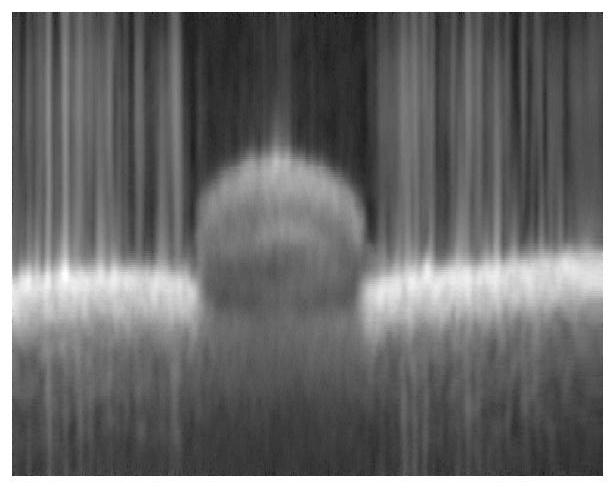 A Blood Vessel Segmentation Method Based on Optical Coherence Tomography System