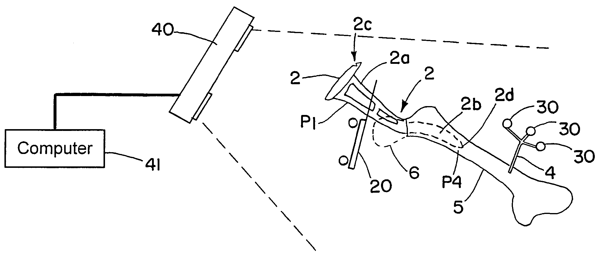 Method and system for determining the location of a medical instrument relative to a body structure