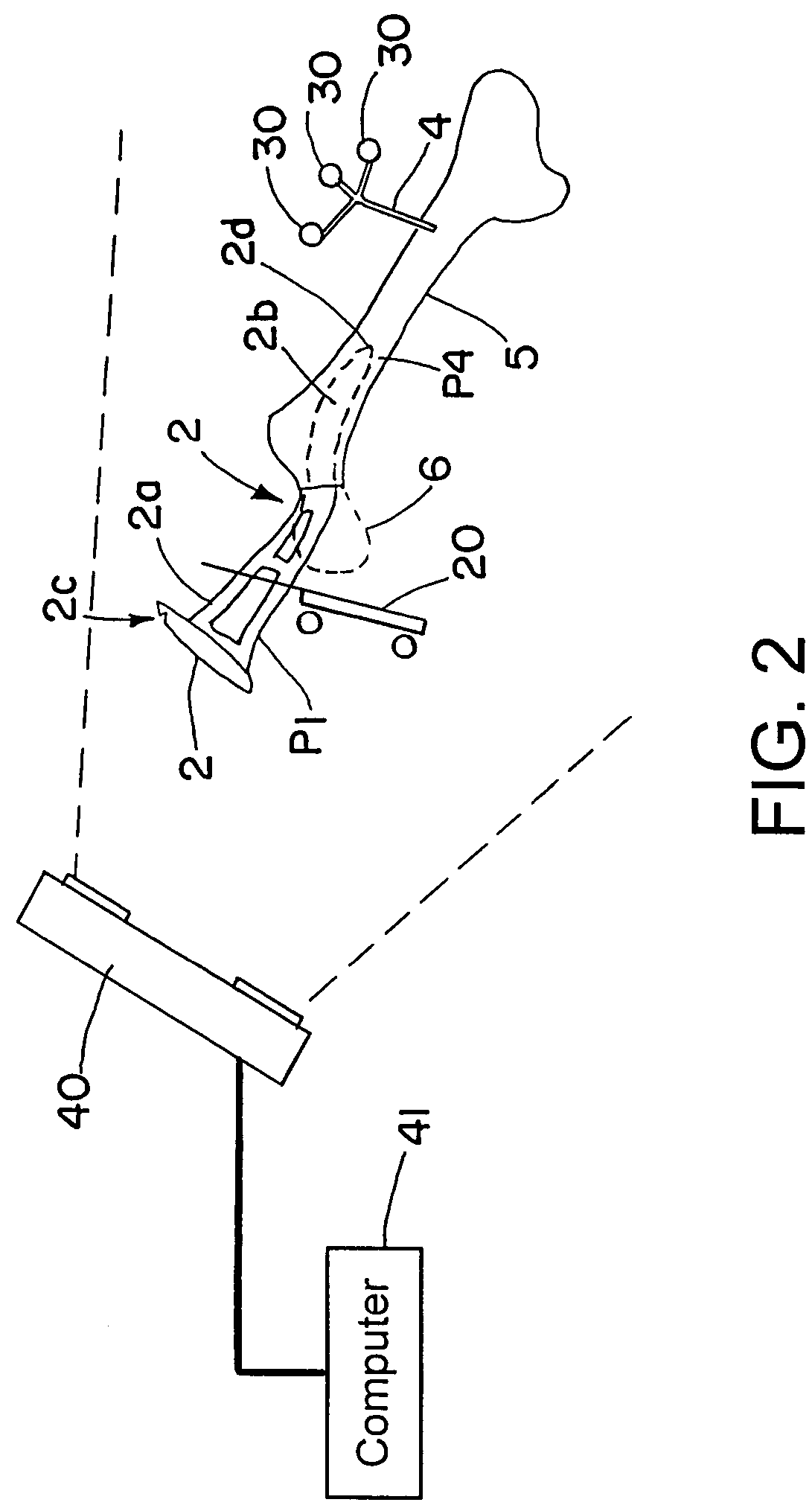Method and system for determining the location of a medical instrument relative to a body structure
