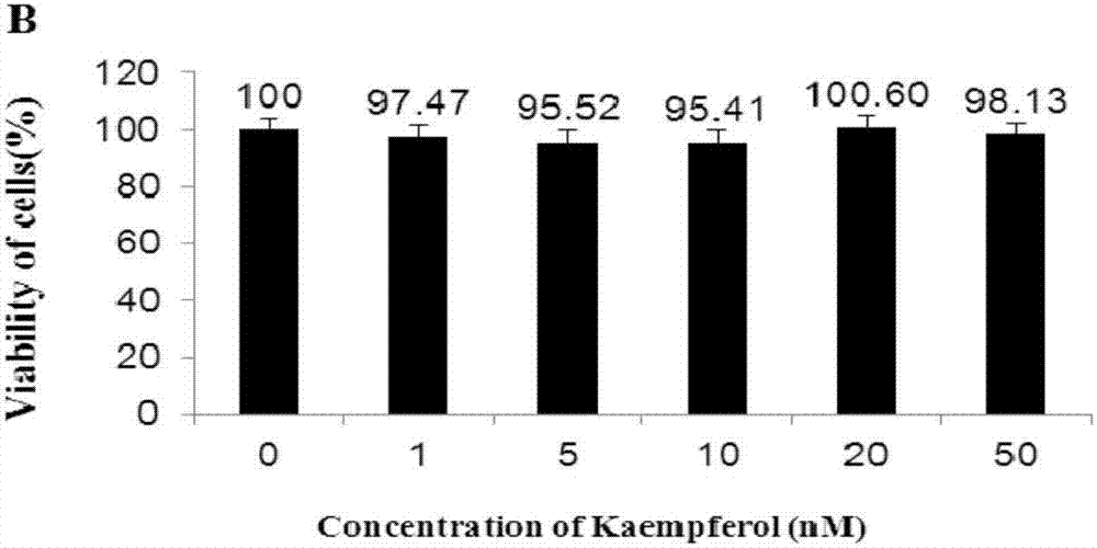 Application of kaempferol to preparation of medicament for preventing and treating retina injury diseases