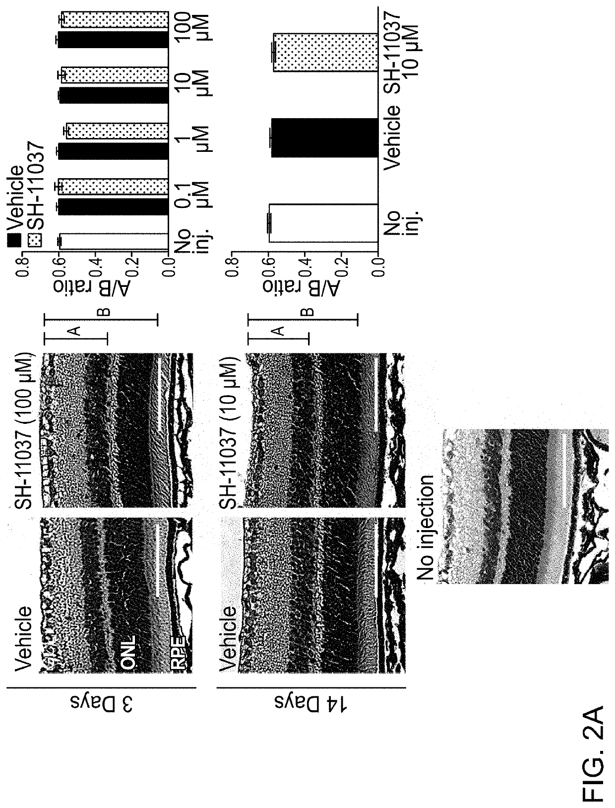 Composition for blocking angiogenesis