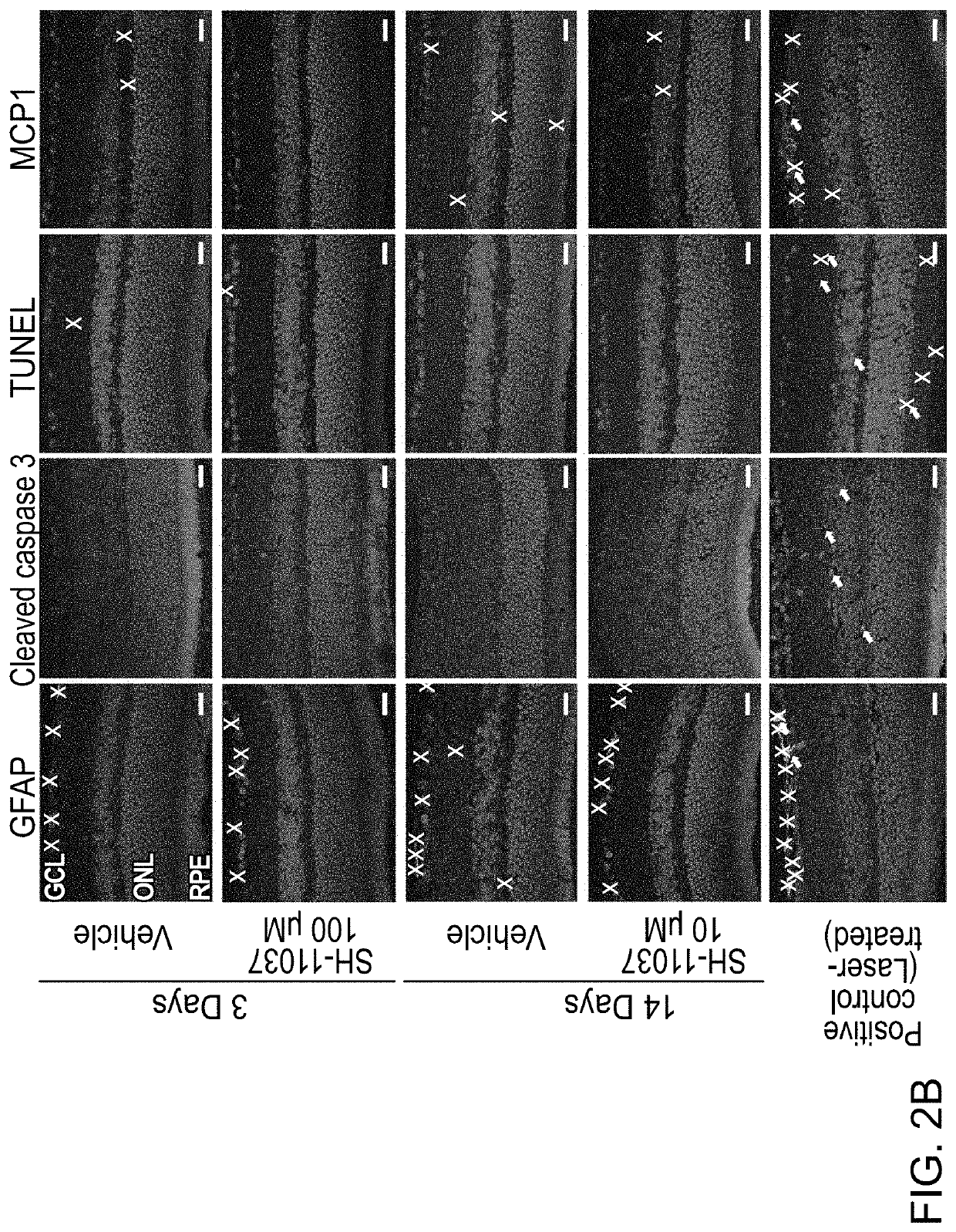 Composition for blocking angiogenesis