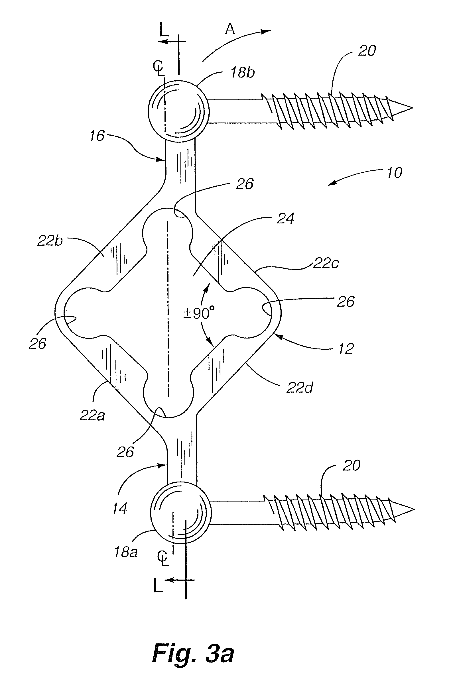 Dynamic fixation device and method of use