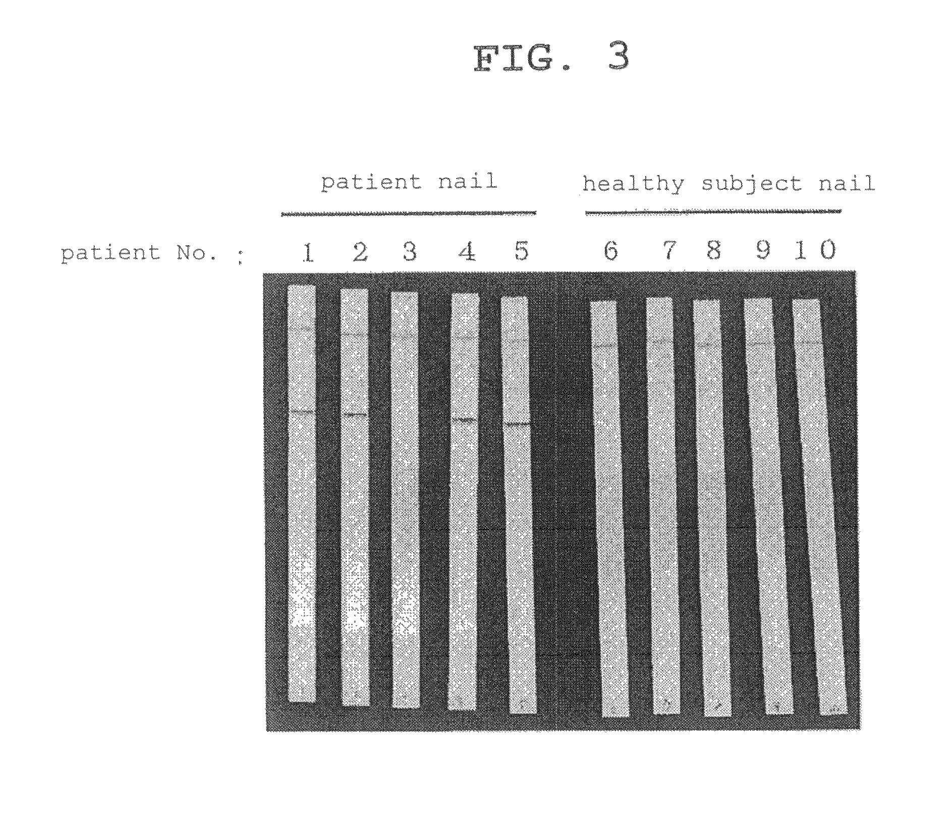 Non-heating detection method for dermatophyte