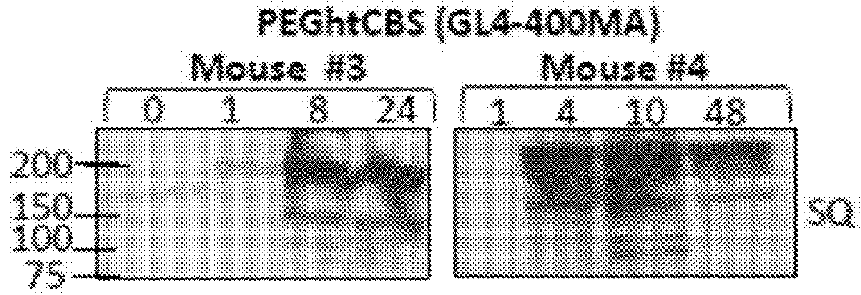 Compositions and methods for treatment of homocystinuria