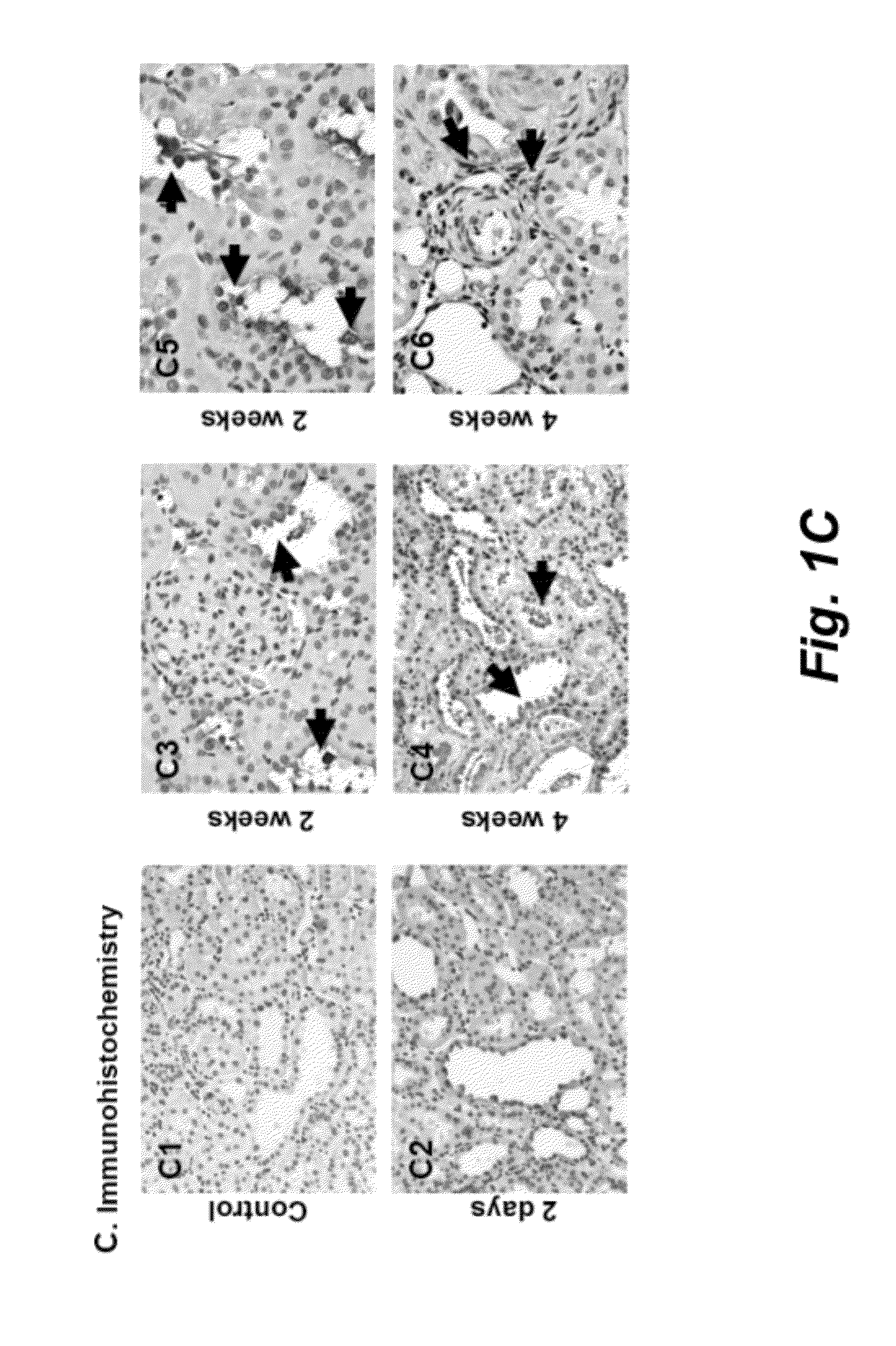 Use of periostin as a novel biomarker