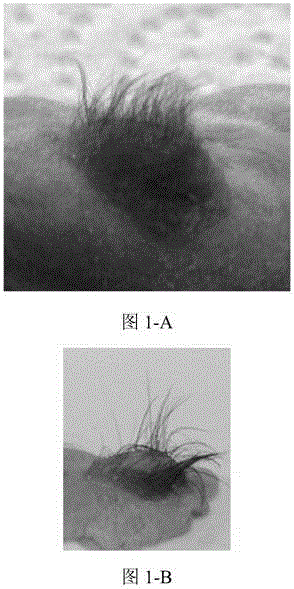 Tissue-engineered epidermis and preparation method thereof