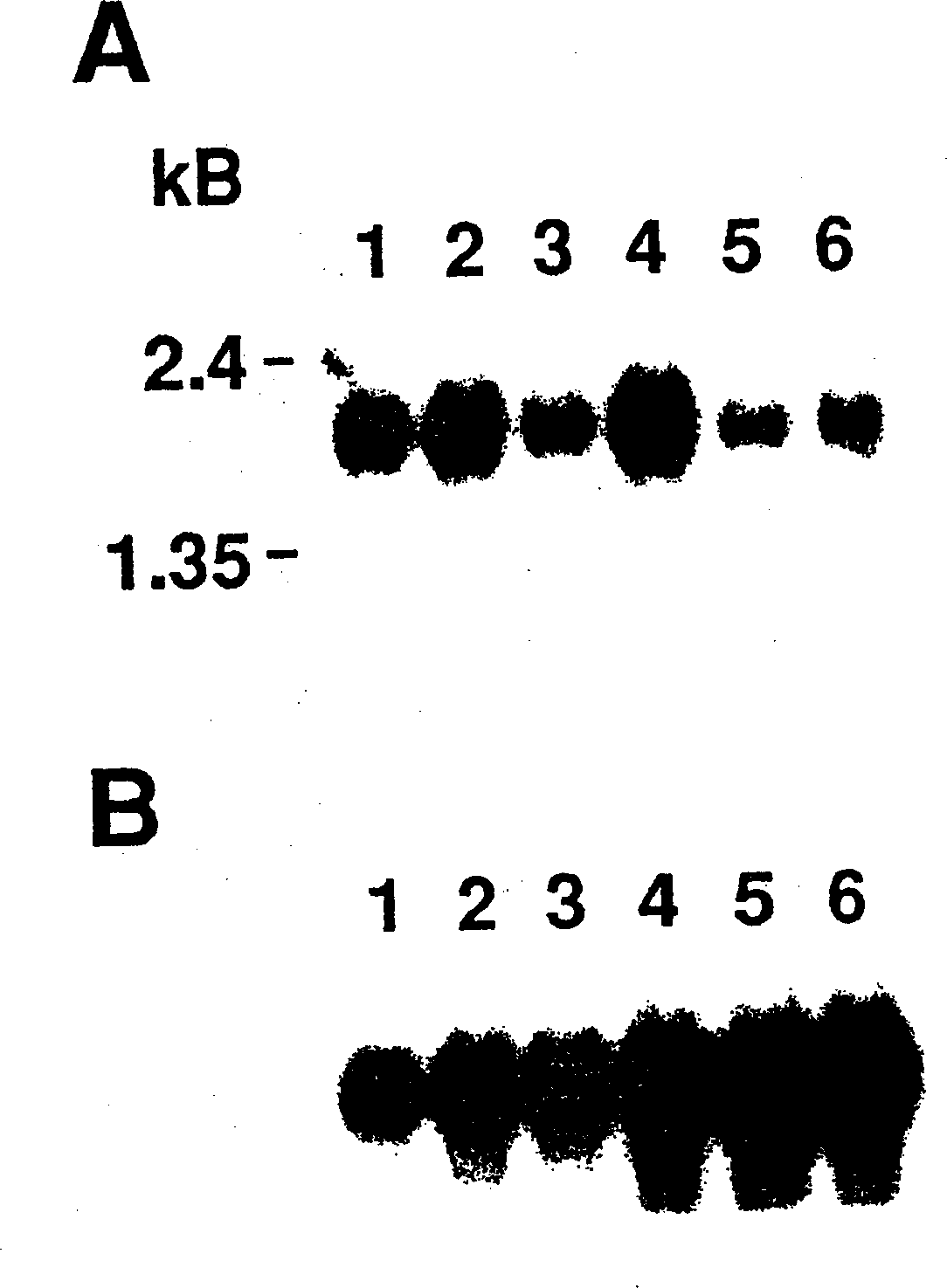 Eosinophil chemotactic factor