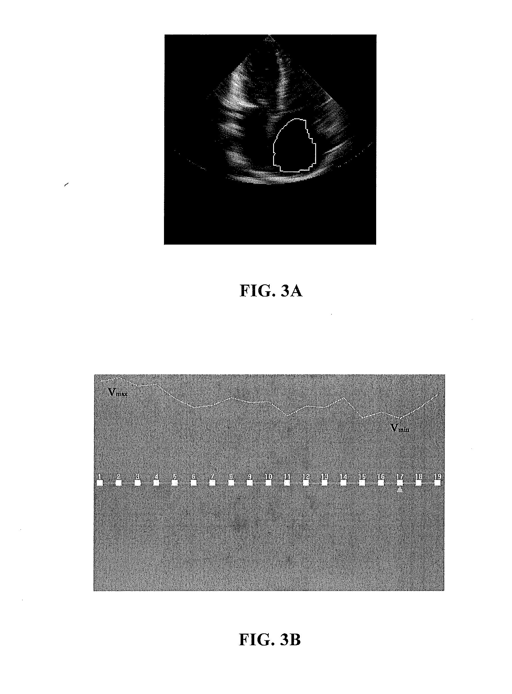 Device and method for determining border of target region of medical images