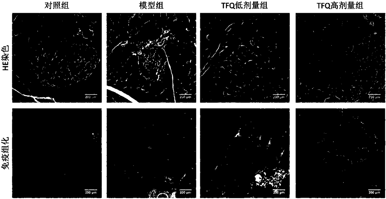 Quzhou fructus aurantii, Quzhou fructus aurantii extract and application of medicine composition containing Quzhou fructus aurantii or Quzhou fructus aurantii extract to maintenance of functions of islet cells