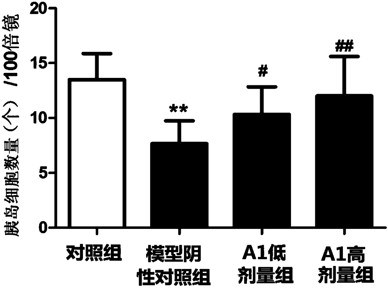 Quzhou fructus aurantii, Quzhou fructus aurantii extract and application of medicine composition containing Quzhou fructus aurantii or Quzhou fructus aurantii extract to maintenance of functions of islet cells