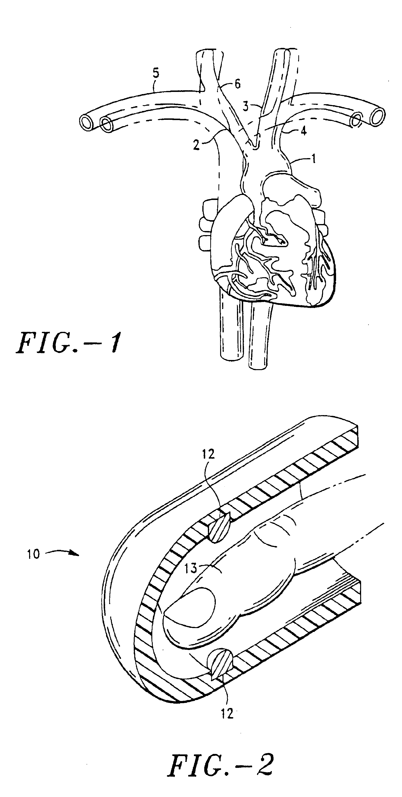 Device and method for noninvasive continuous determination of physiologic characteristics