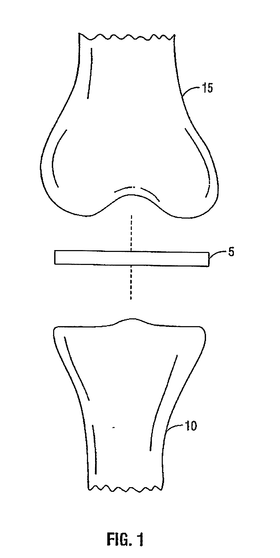 Method and apparatus for meniscal repair