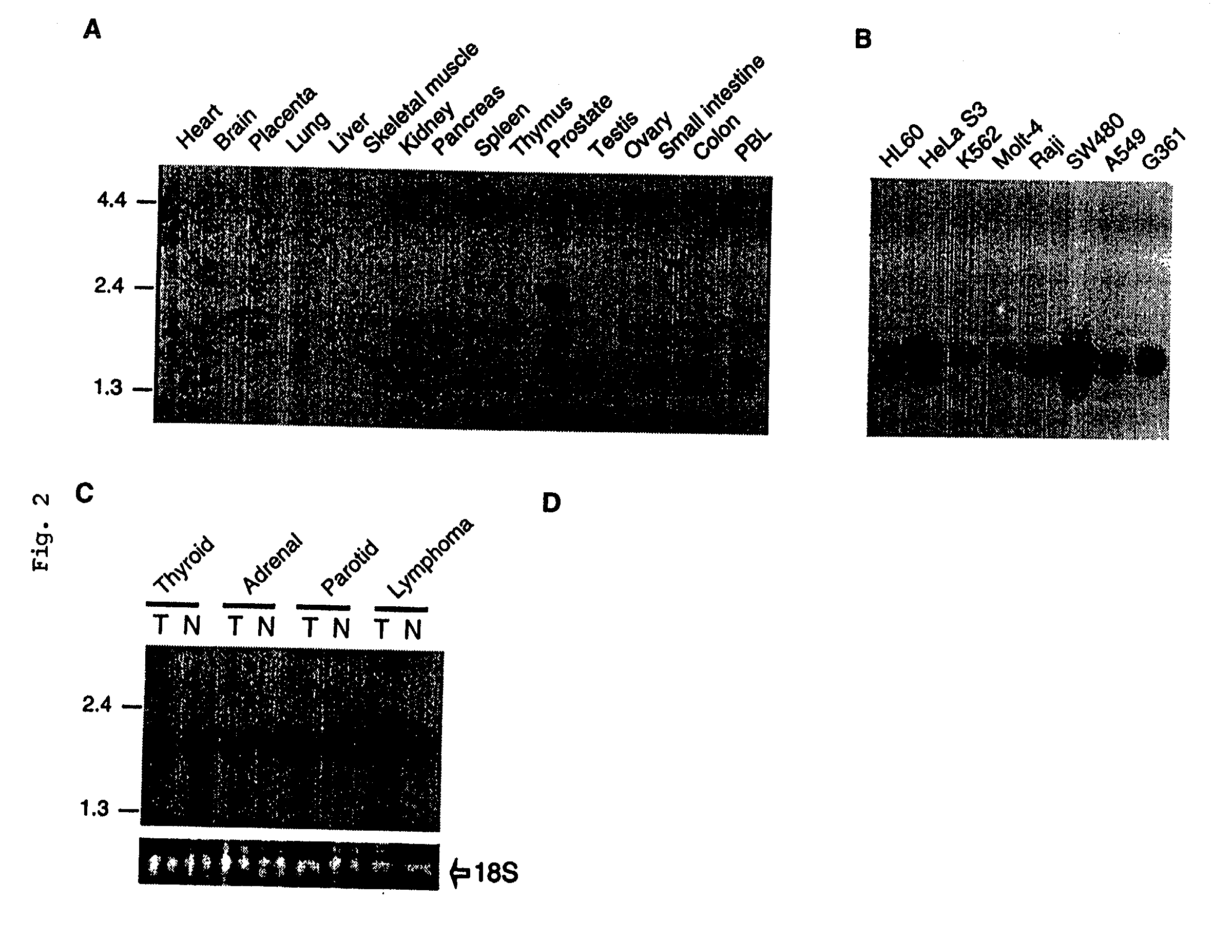 APRIL- a novel protein with growth effects