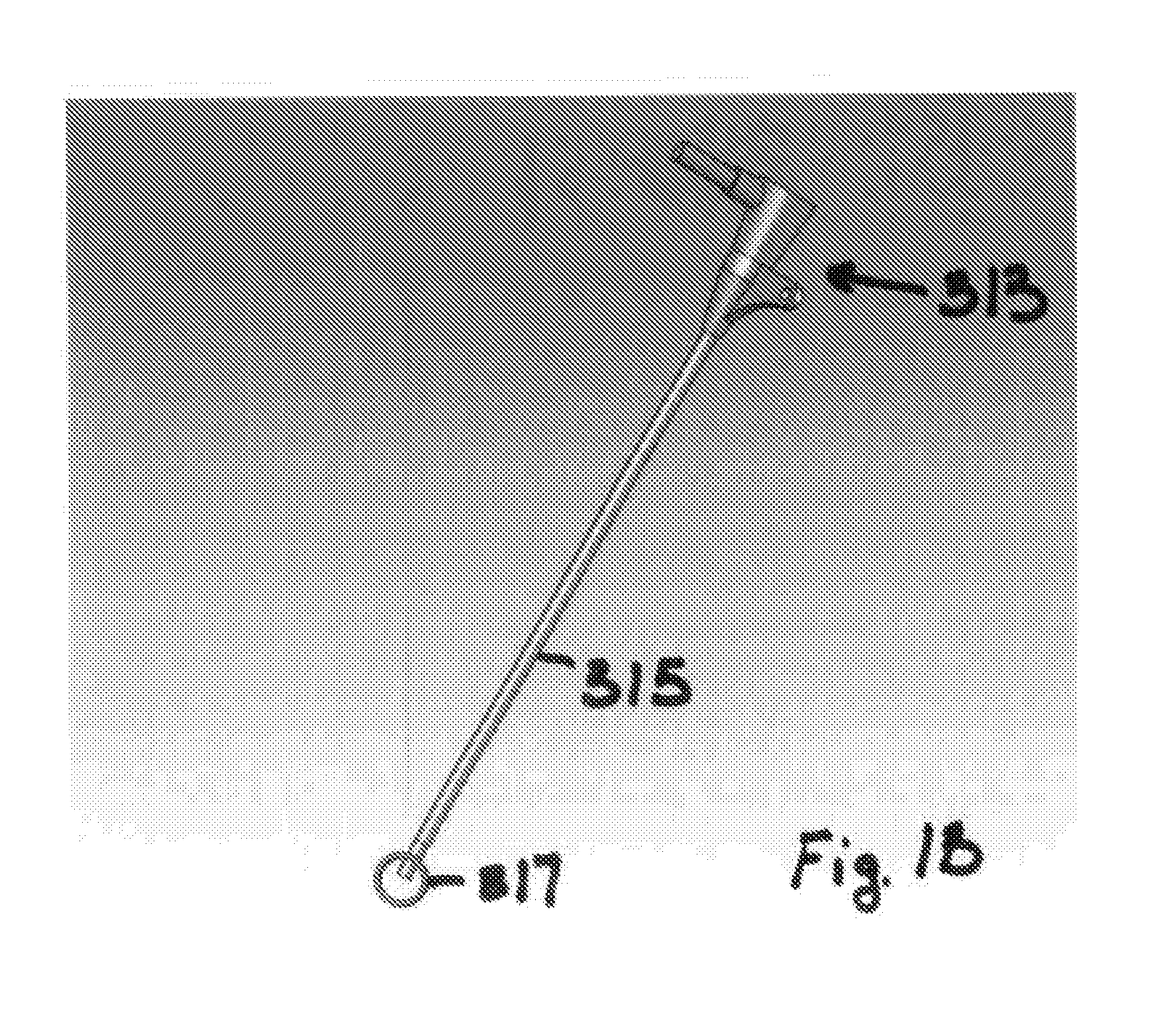 Systems and methods for puncture closure