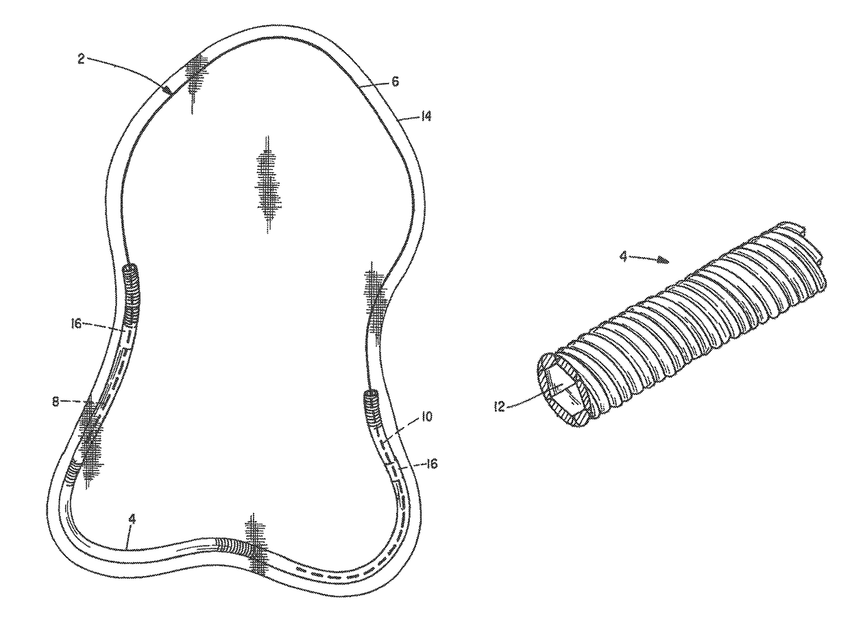 Hernia patch frame incorporating bio-absorbable material