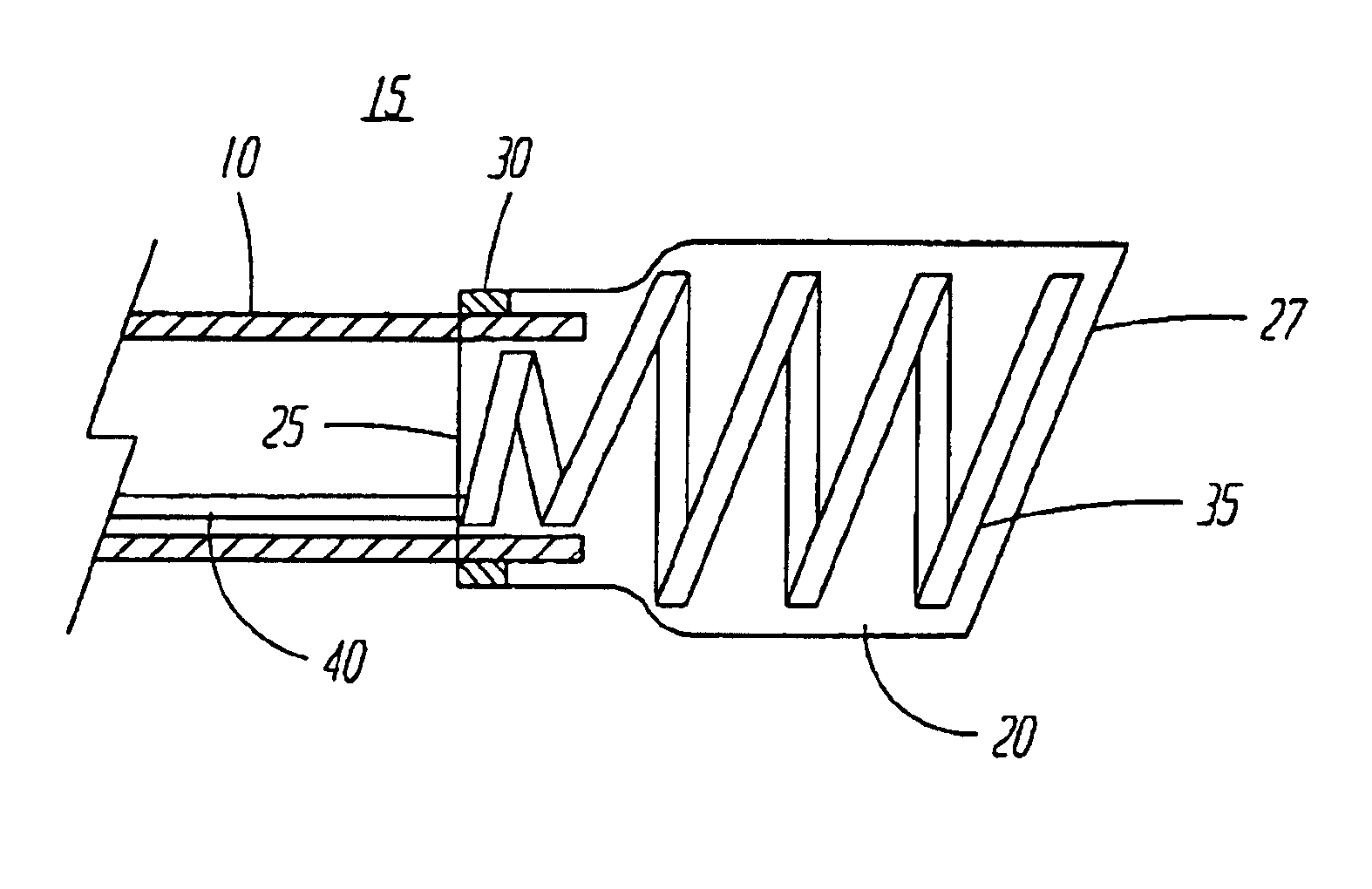 Systems and methods for detaching a covering from an implantable medical device