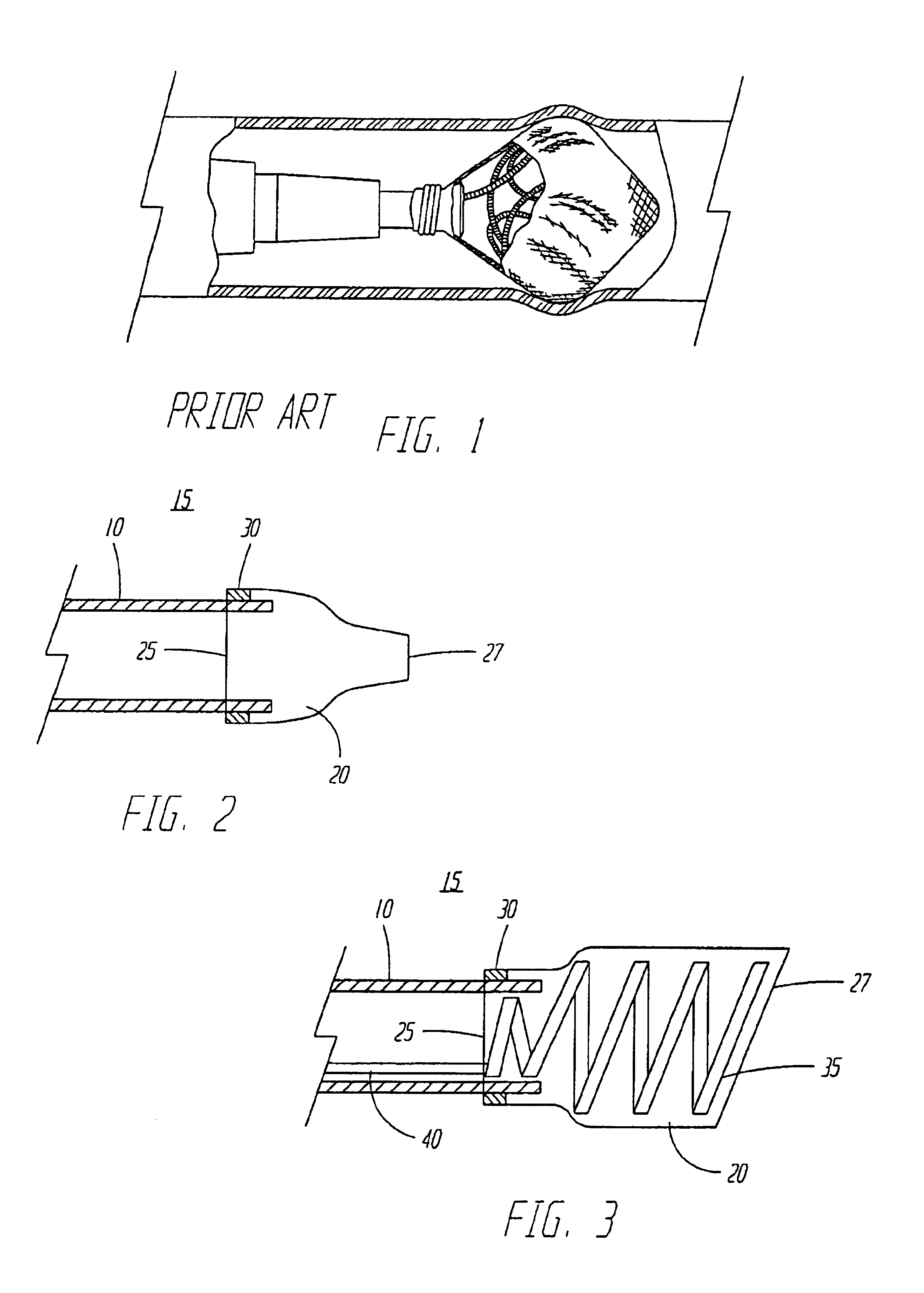 Systems and methods for detaching a covering from an implantable medical device