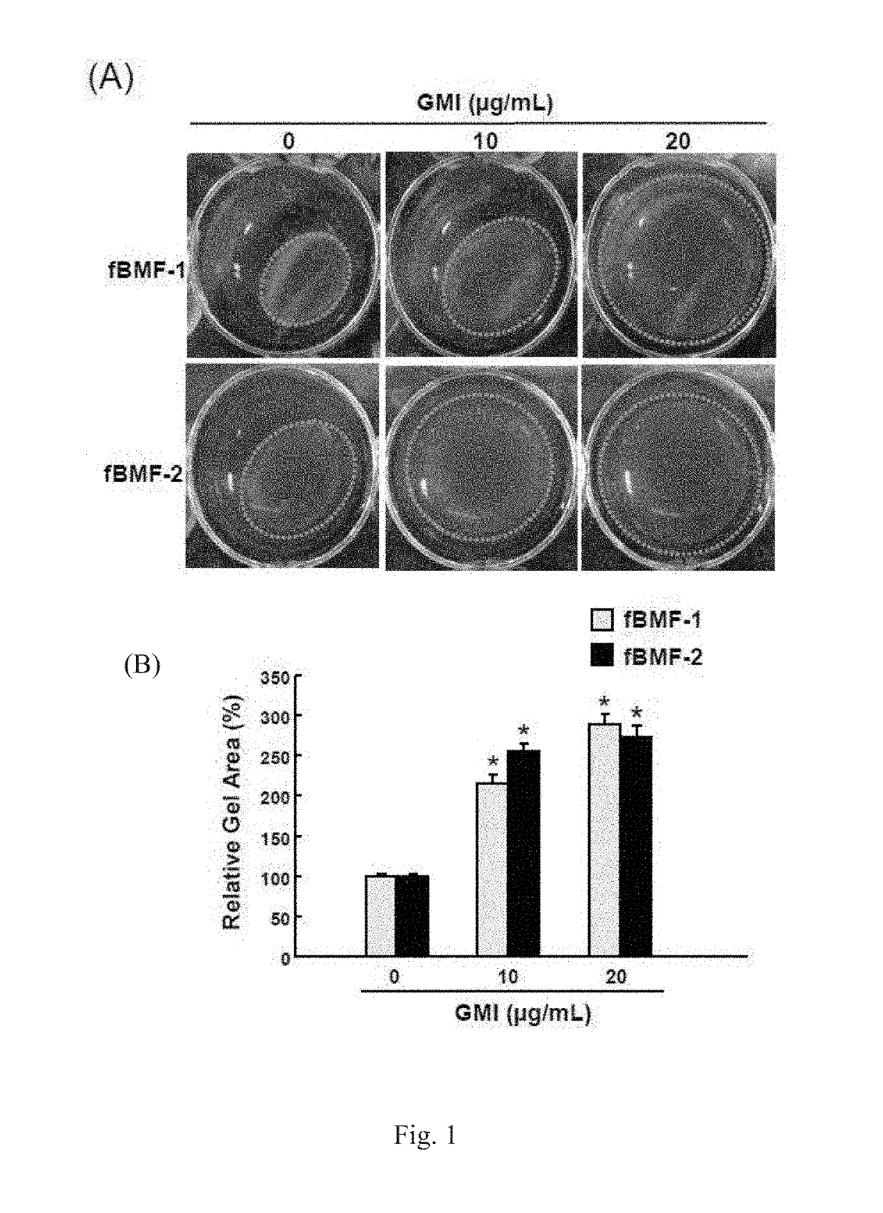 Use of immunomodulatory protein from ganoderma in inhibiting fibrosis