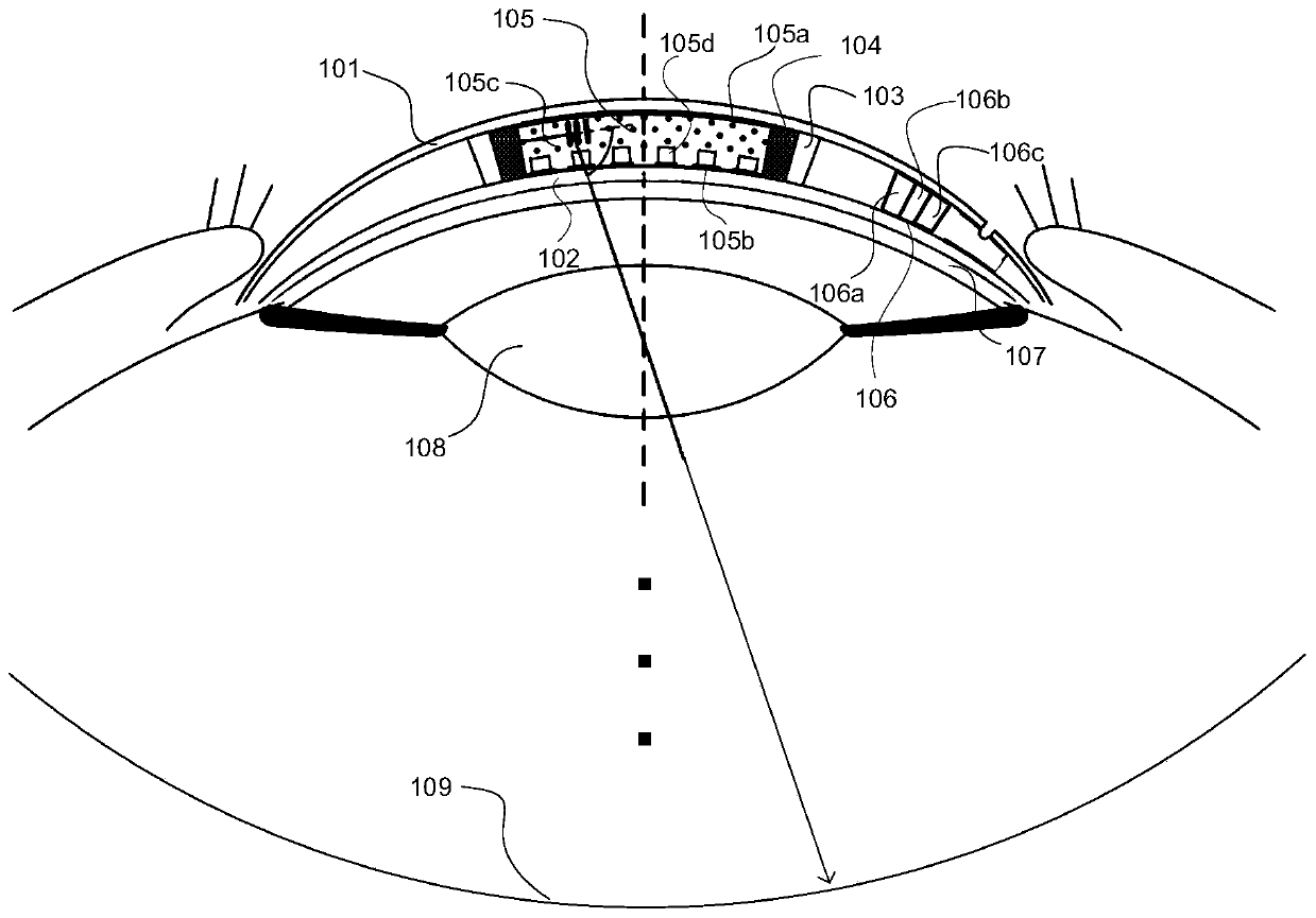 Intraocular display device based on retinal scanning