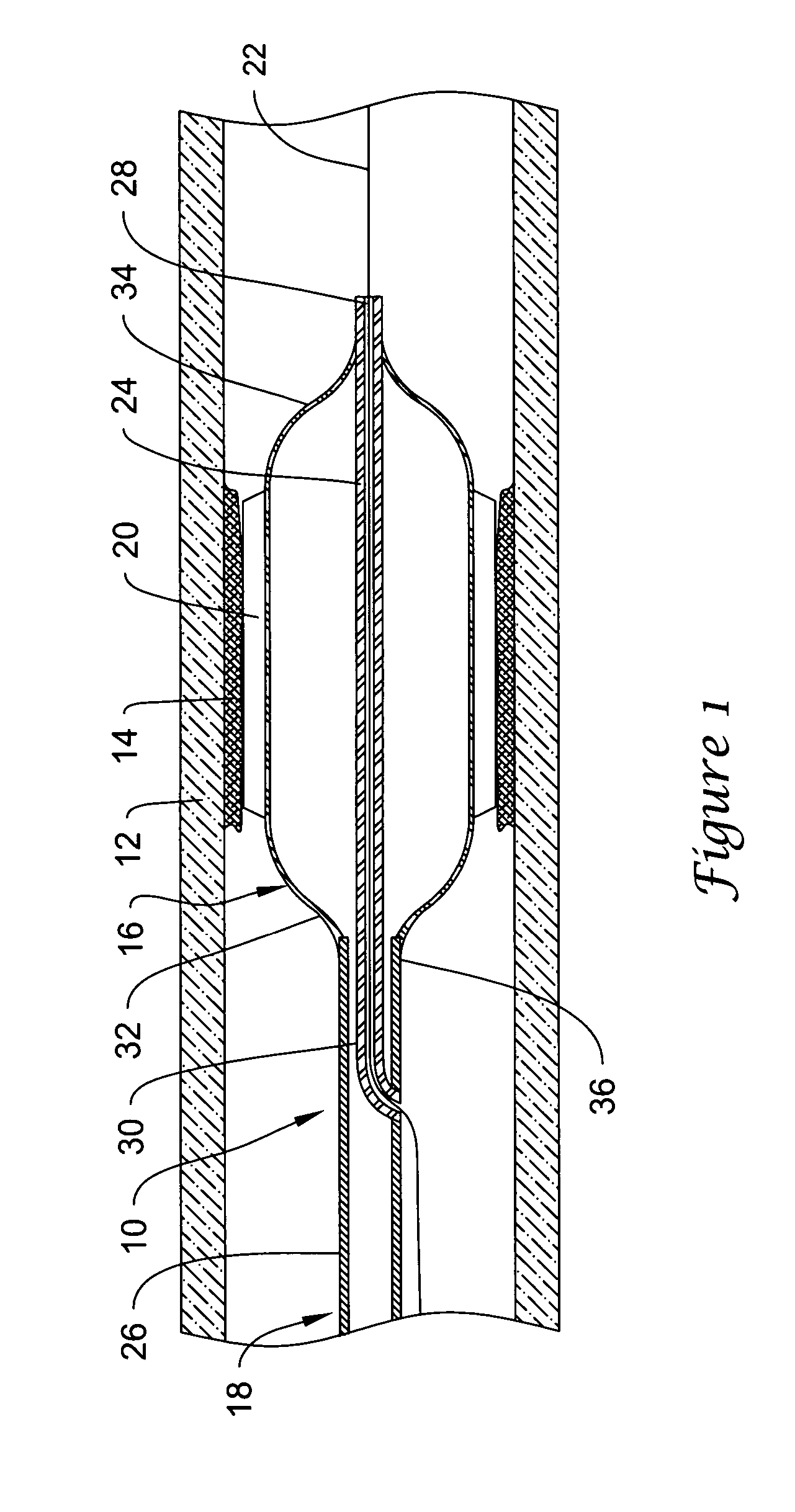 Cutting balloon catheter and method for blade mounting