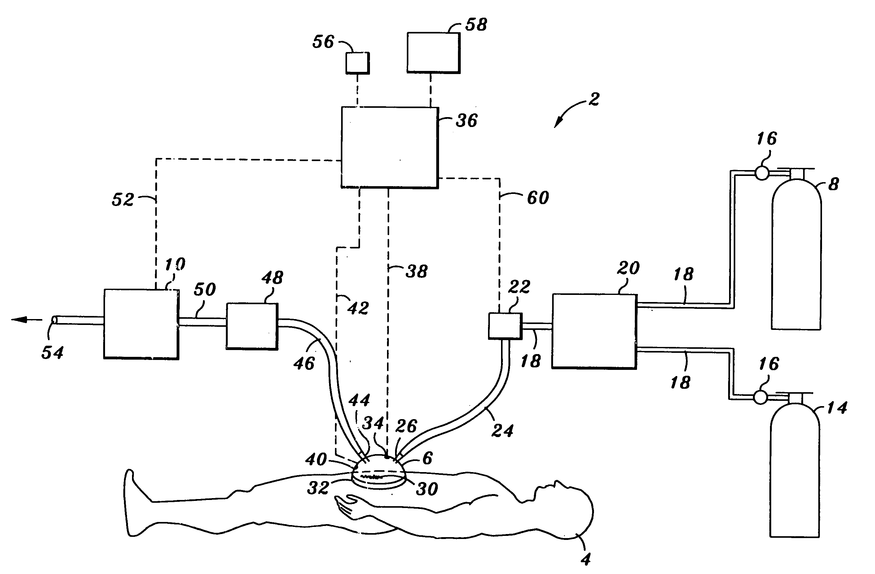 Device and method for treatment of surface infections with nitric oxide