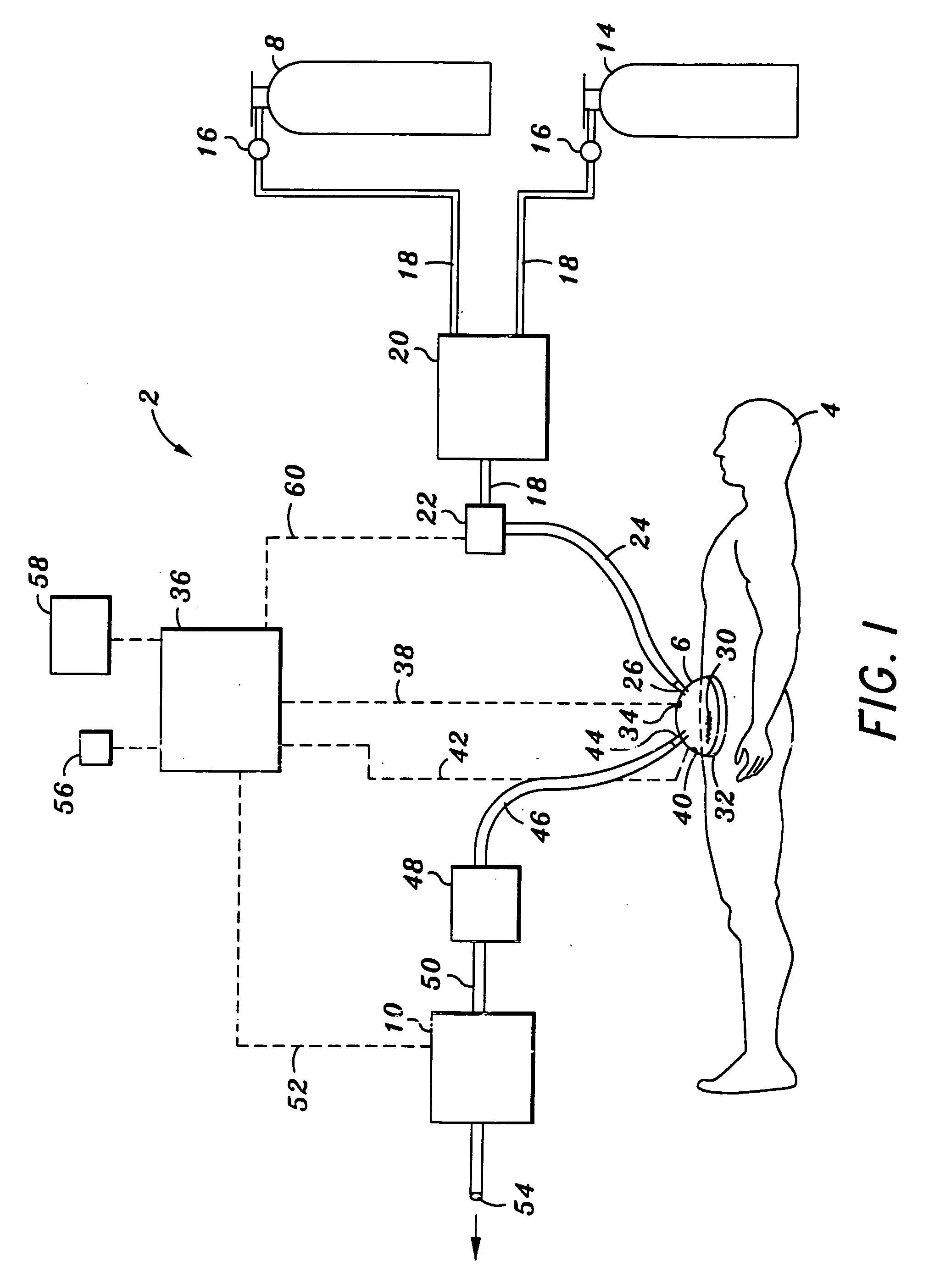 Device and method for treatment of surface infections with nitric oxide