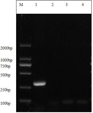 Primers for triple PCR of three types of sheep pathogenic mycoplasmas and detection method