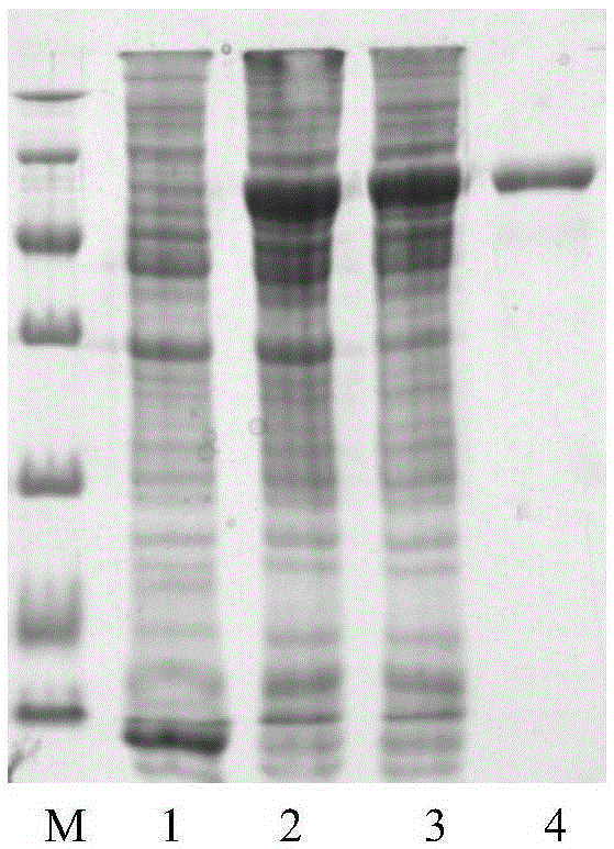 Endochondroitin sulfate/dermatan sulfate 4-o-sulfatase and its coding gene and application