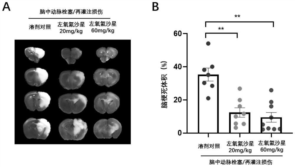 Application of levofloxacin or pharmaceutically acceptable salt thereof in preparation of drugs or health products for resisting cerebral ischemia-reperfusion injury