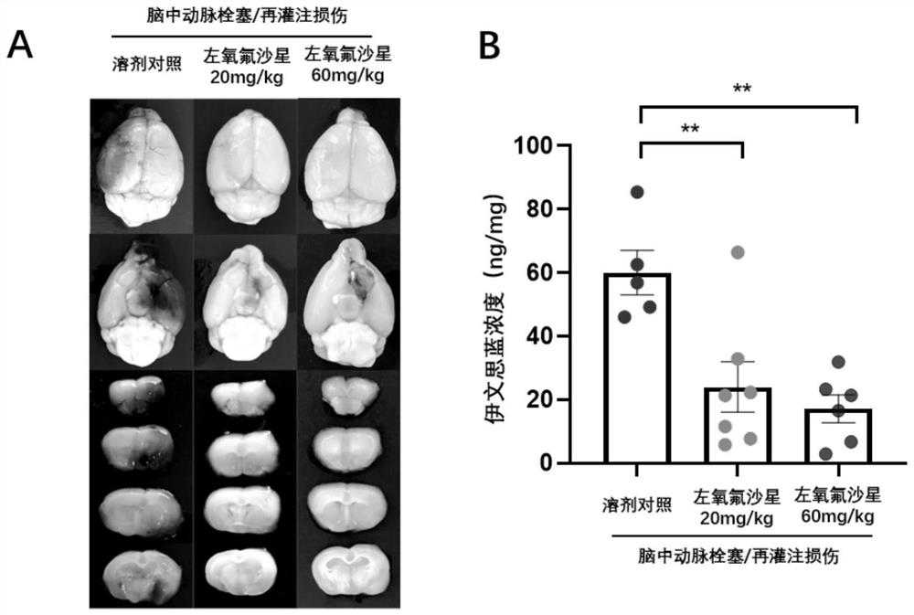 Application of levofloxacin or pharmaceutically acceptable salt thereof in preparation of drugs or health products for resisting cerebral ischemia-reperfusion injury