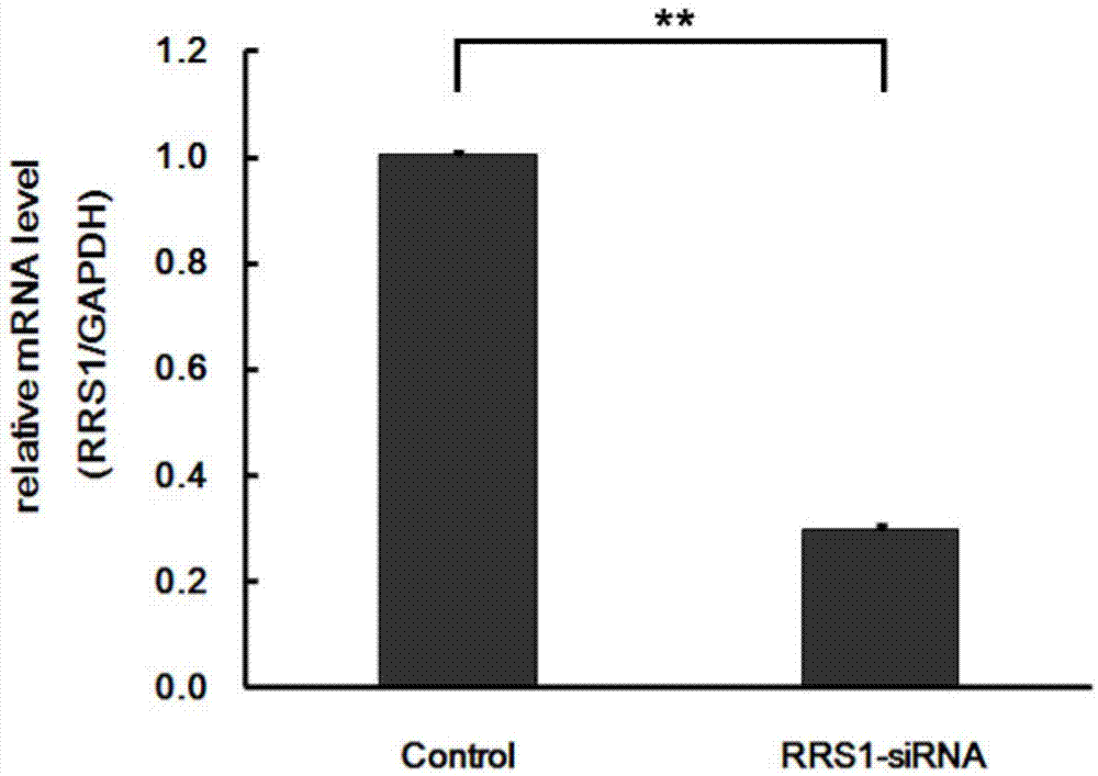 Applications of human RRS1 gene and inhibitor