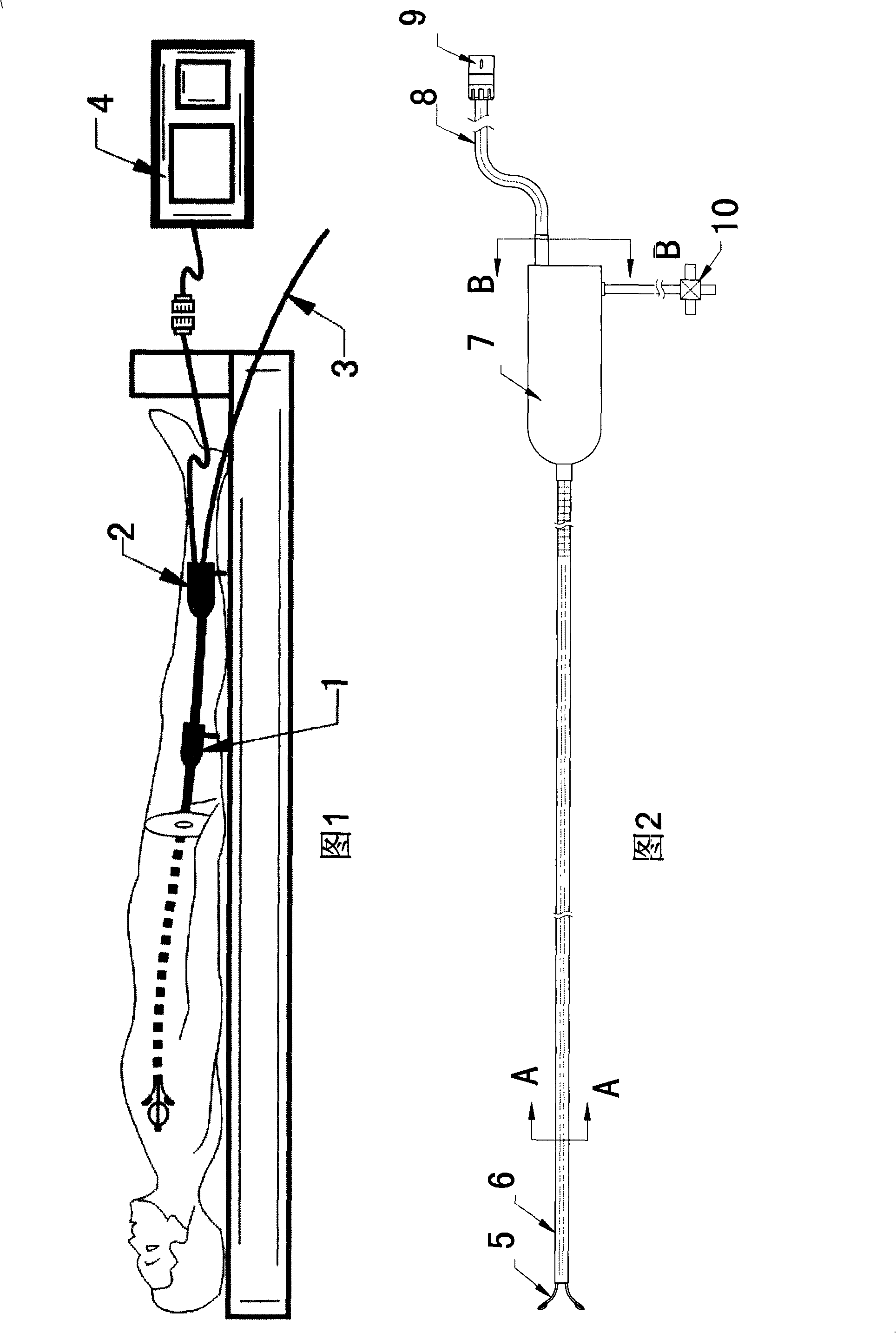 Cardiac intervention ablation catheter